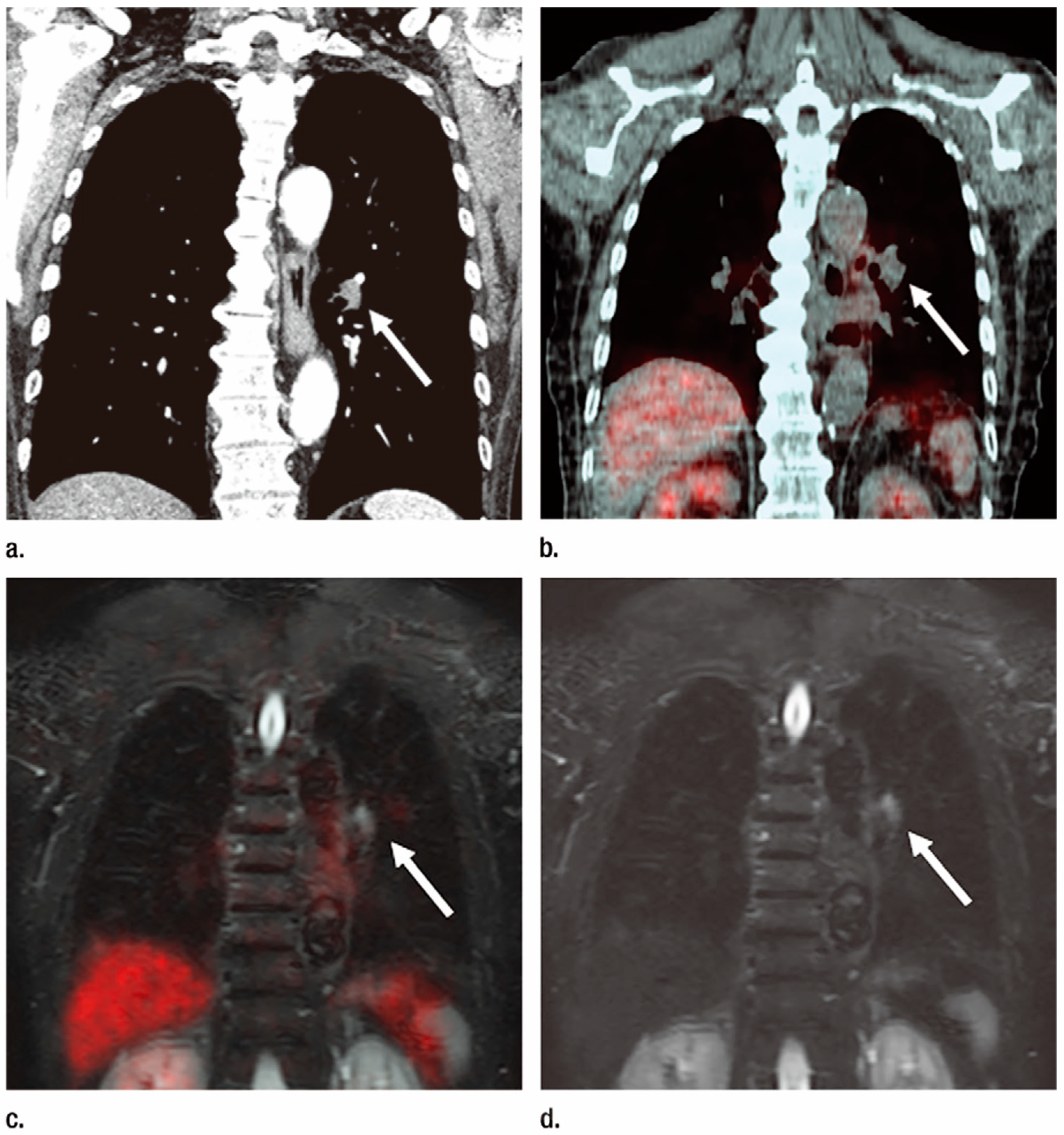 Cancers 15 00950 g004