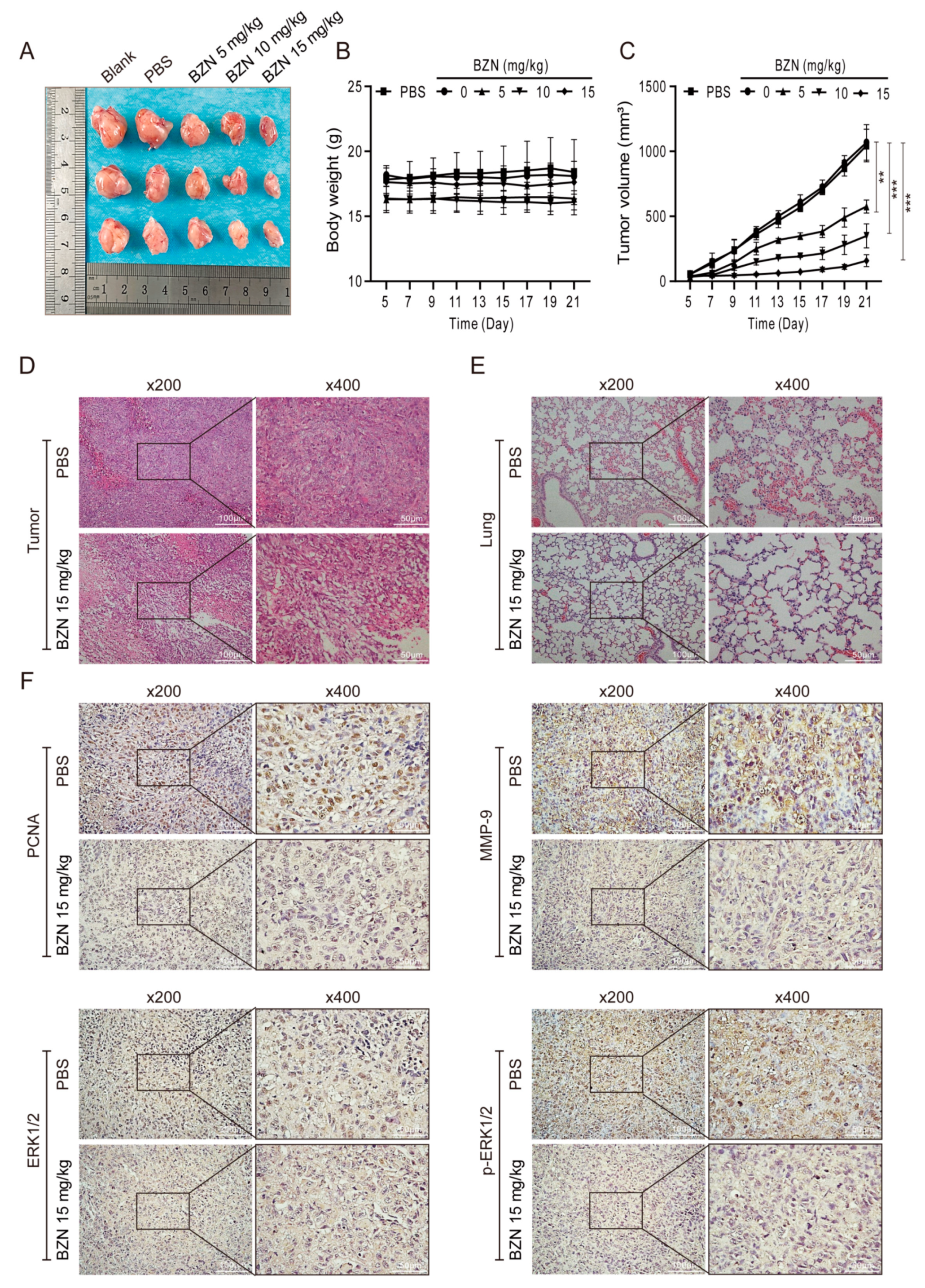 Cancers 15 00961 g005