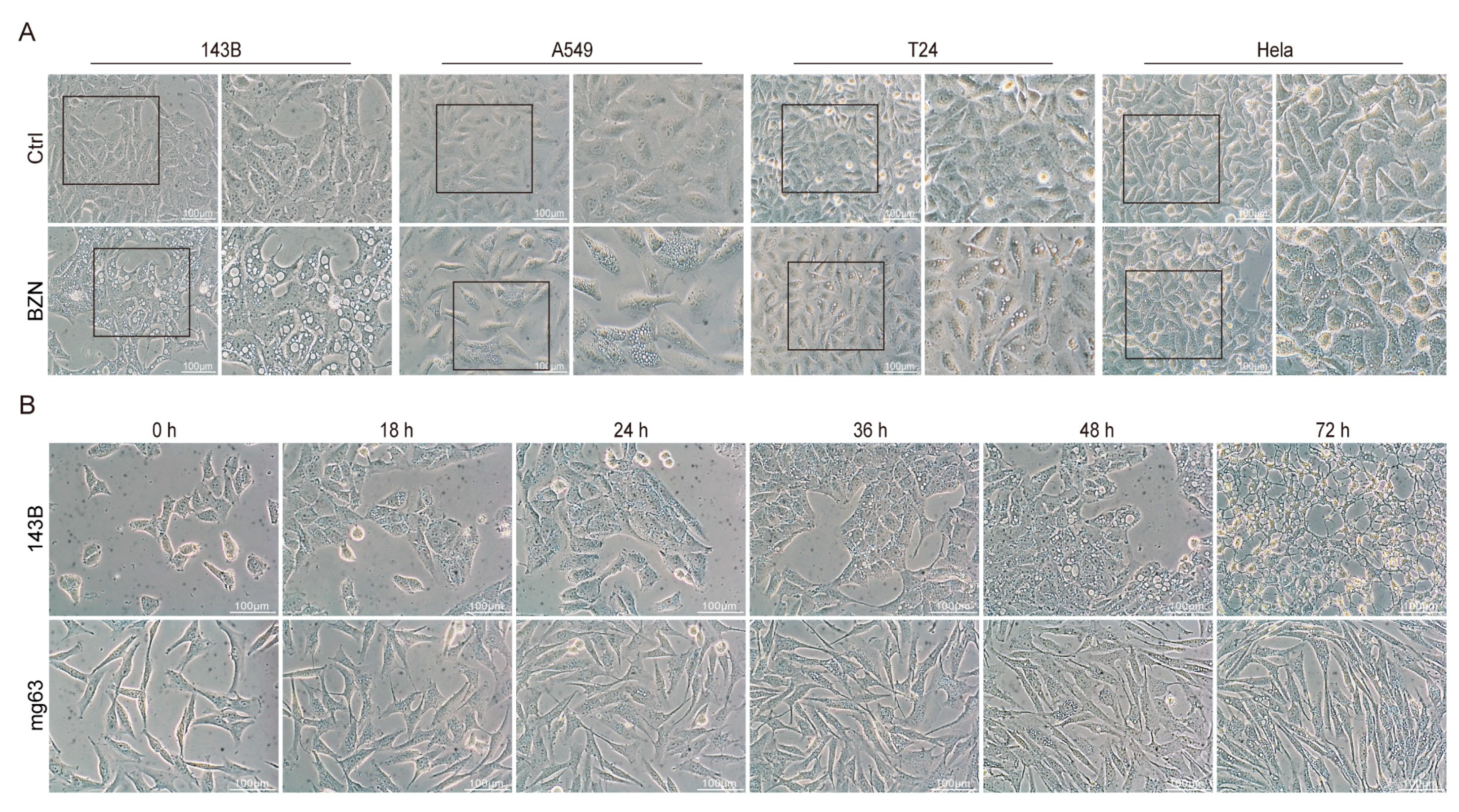 Cancers 15 00961 g006