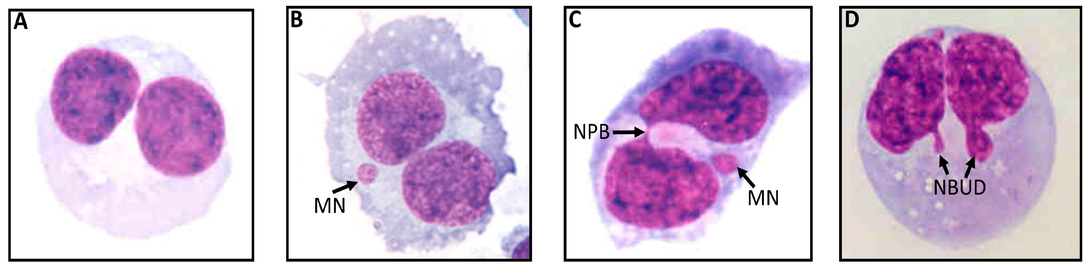 Cancers 15 00979 g001 Cancers 15 00979 g001