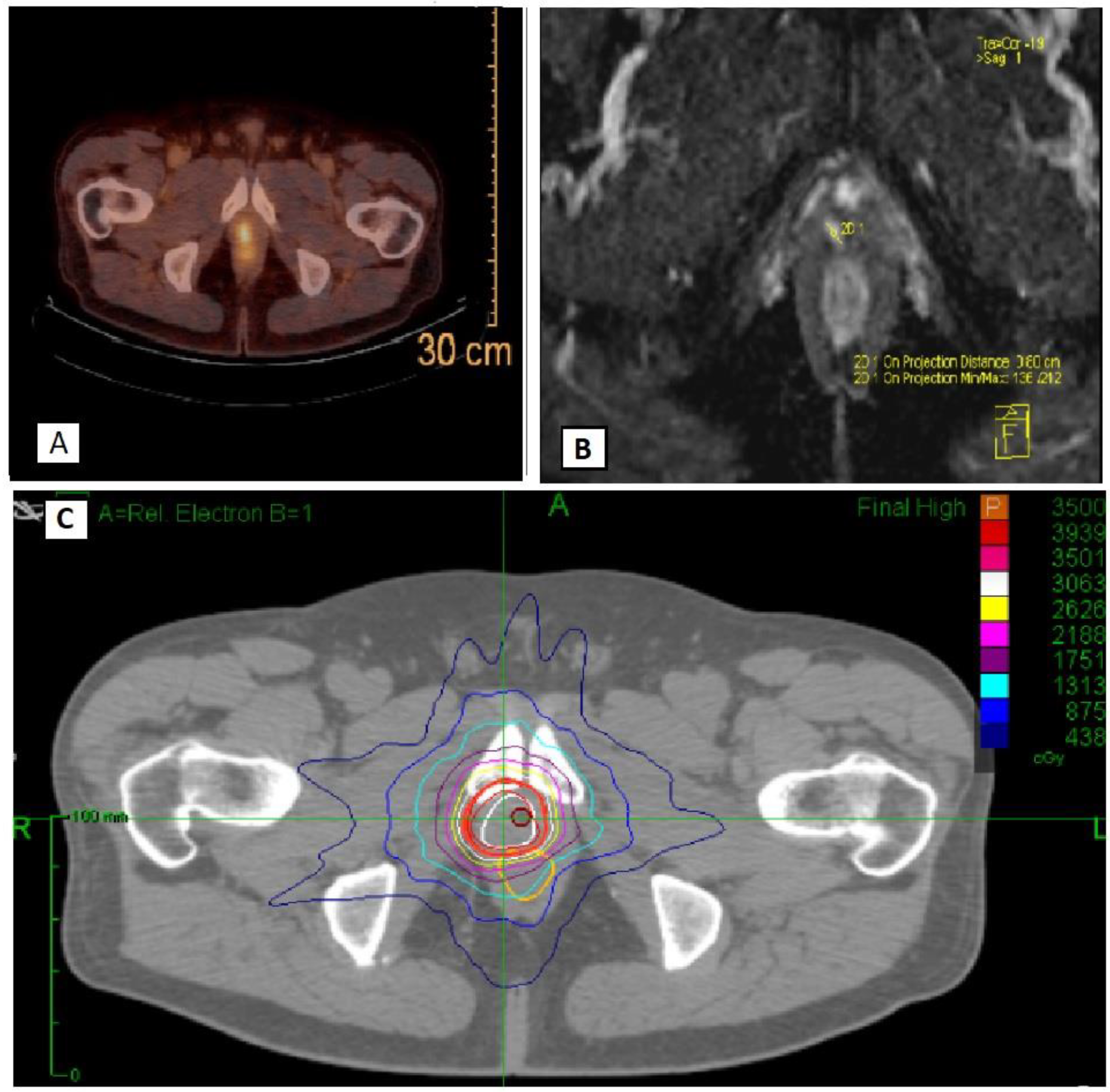 Cancers 15 00992 g001