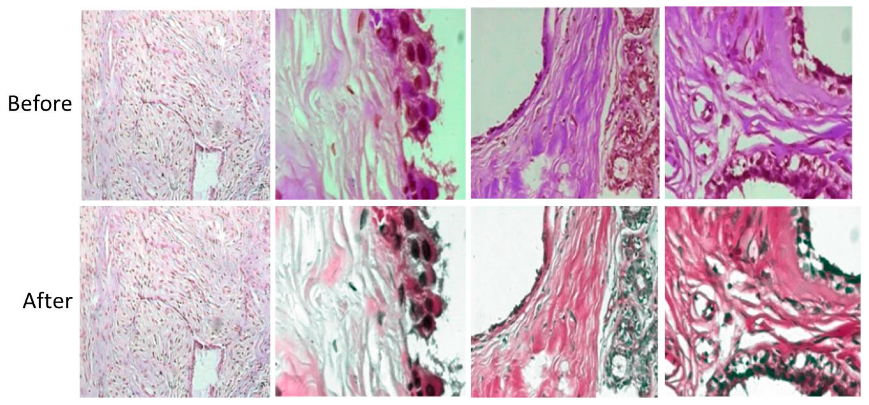 Cancers 15 01013 g005