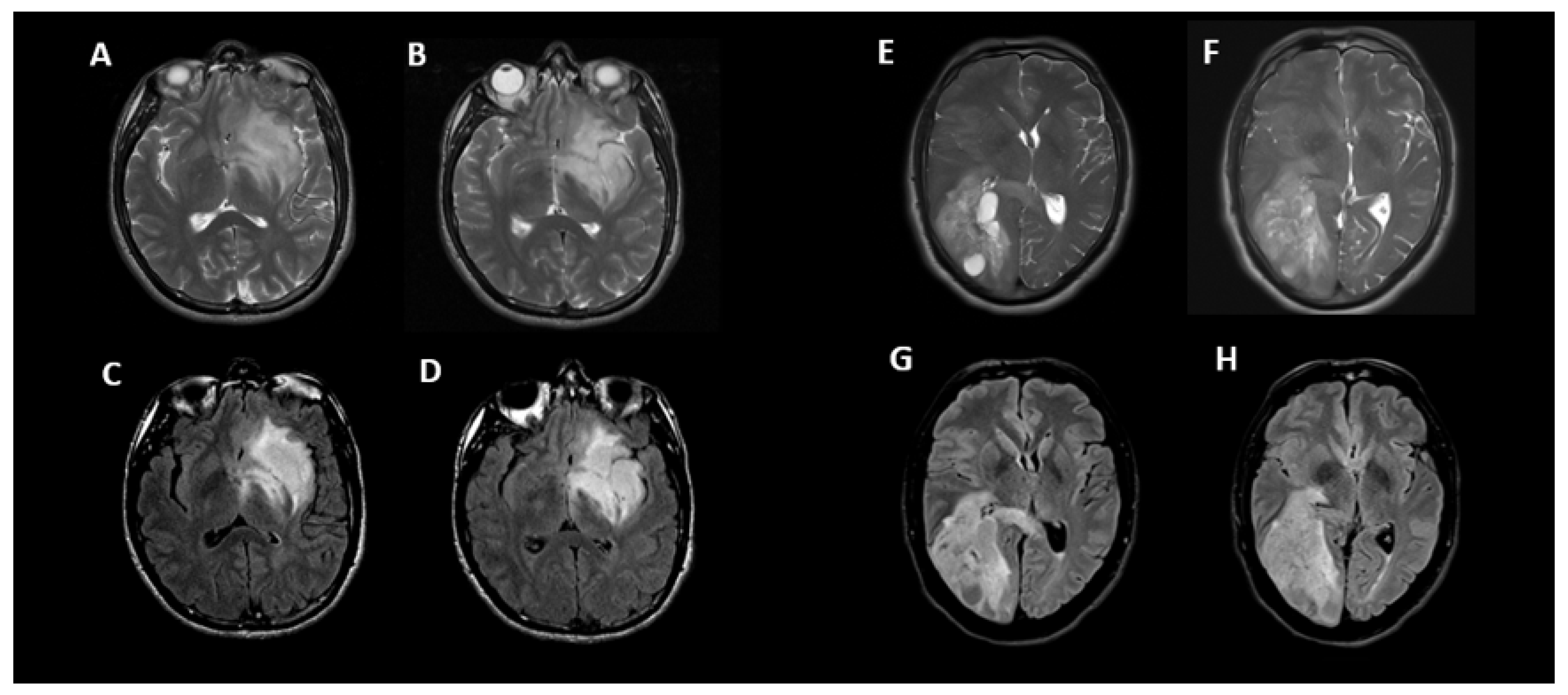 Cancers 15 01037 g004