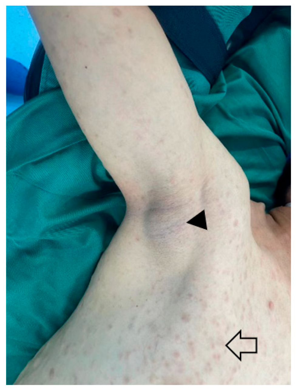 Cancers 15 01077 g001