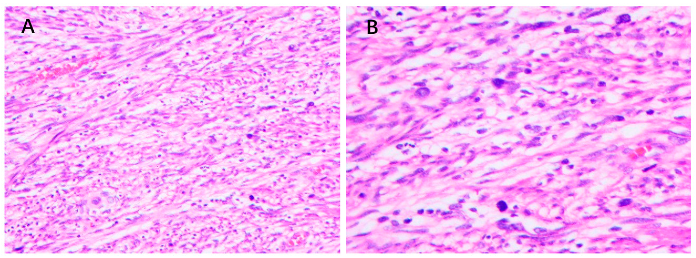 Cancers 15 01077 g005