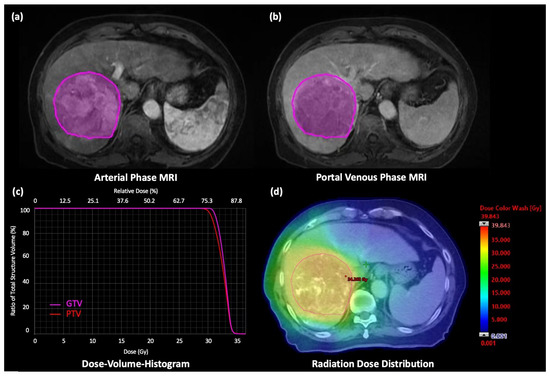 Cancers 15 01105 g001