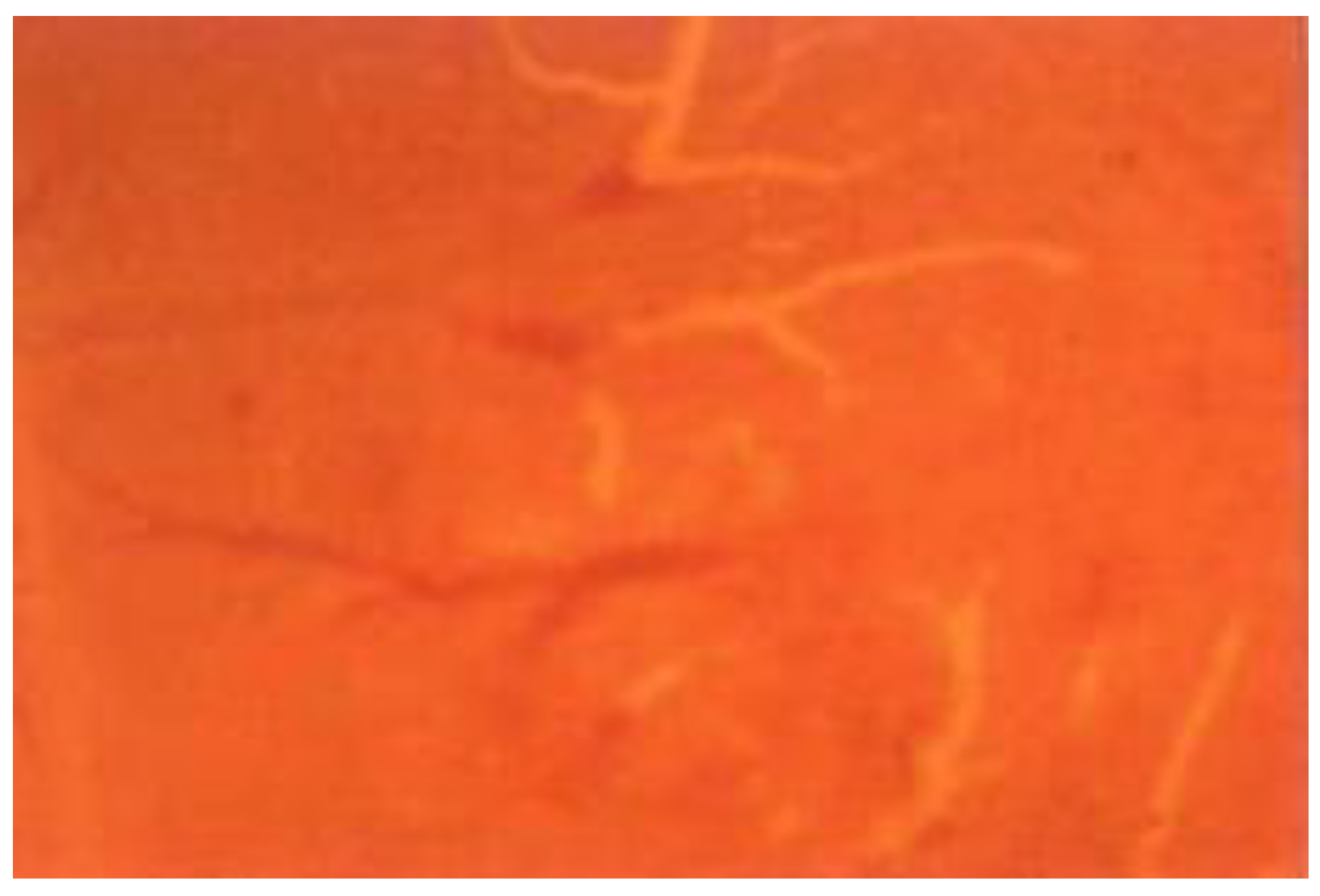 Cancers 15 01110 g002