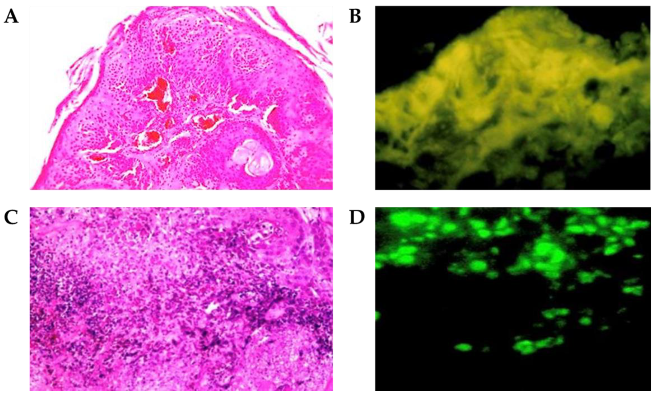 Cancers 15 01110 g004