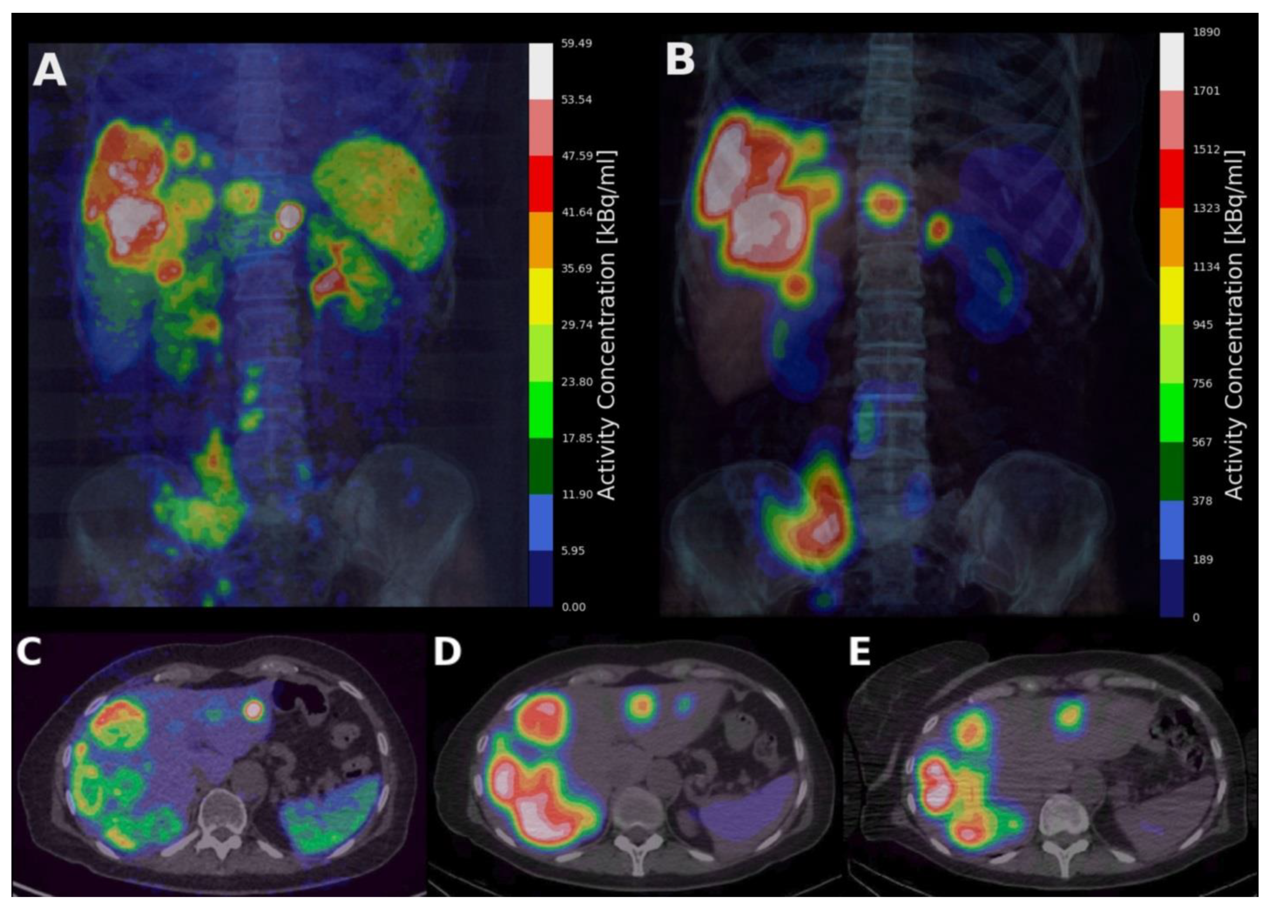 Cancers 15 01134 g001