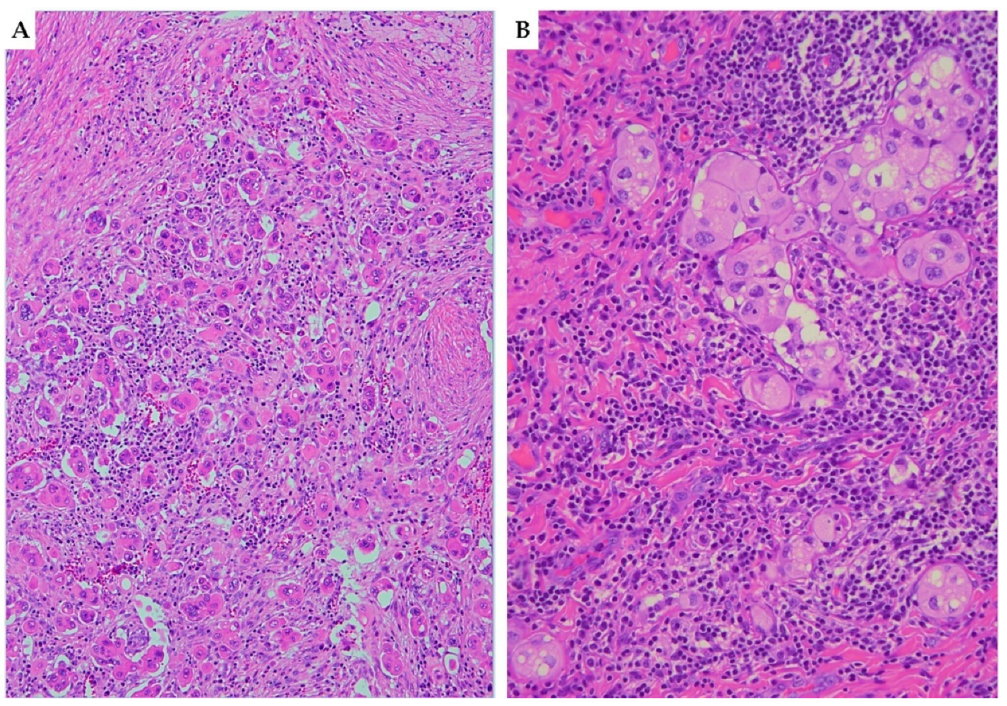 Cancers 15 01137 g001