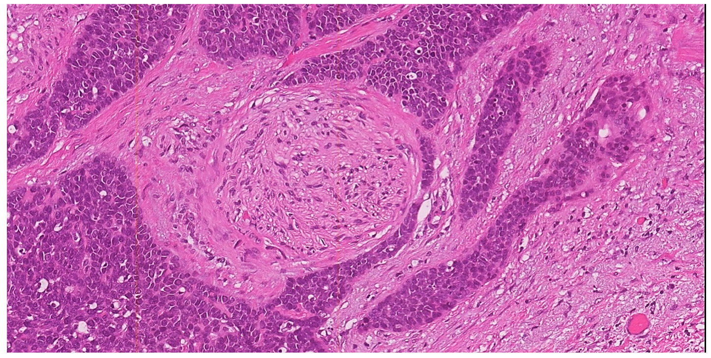 Cancers 15 01137 g002