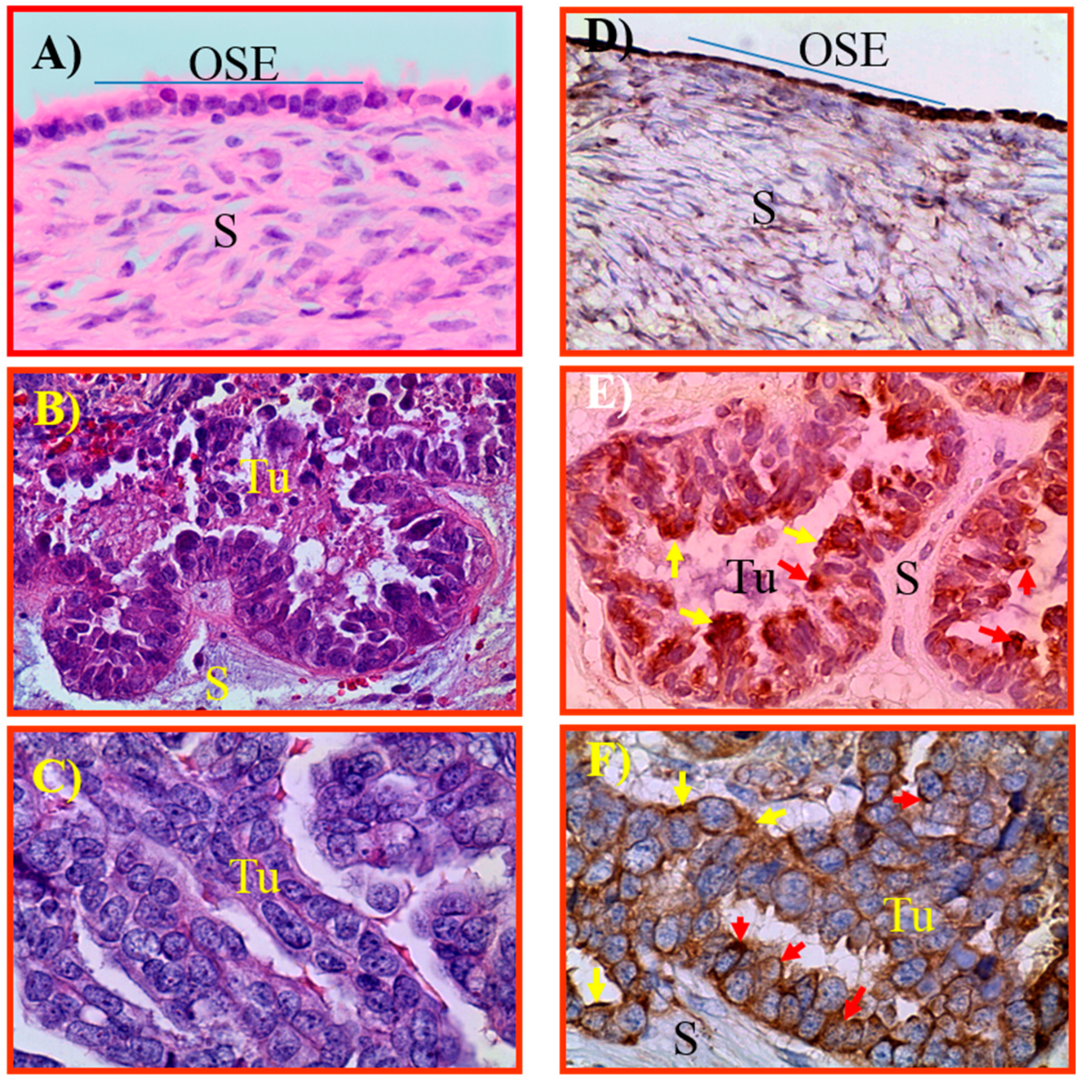 Cancers 15 01140 g001