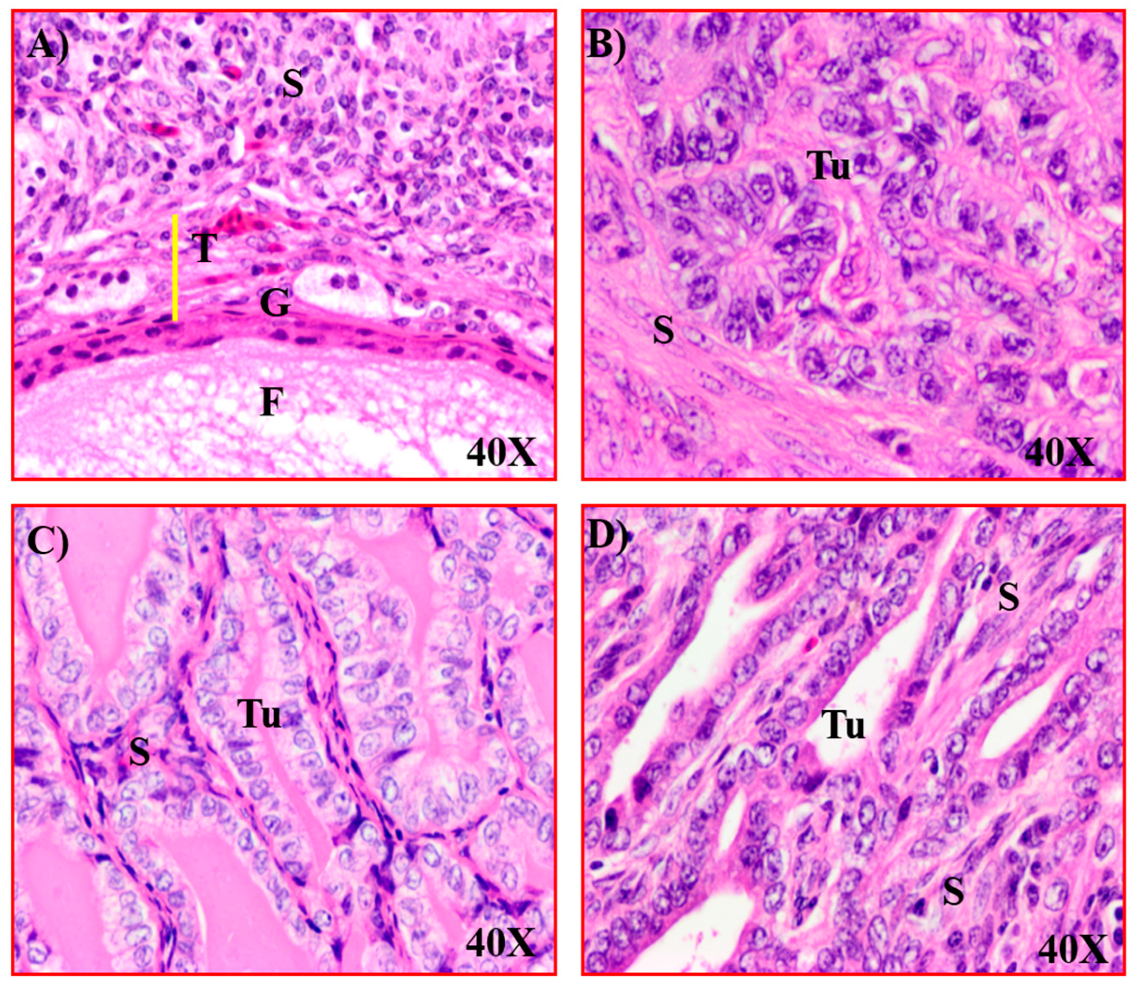Cancers 15 01140 g005