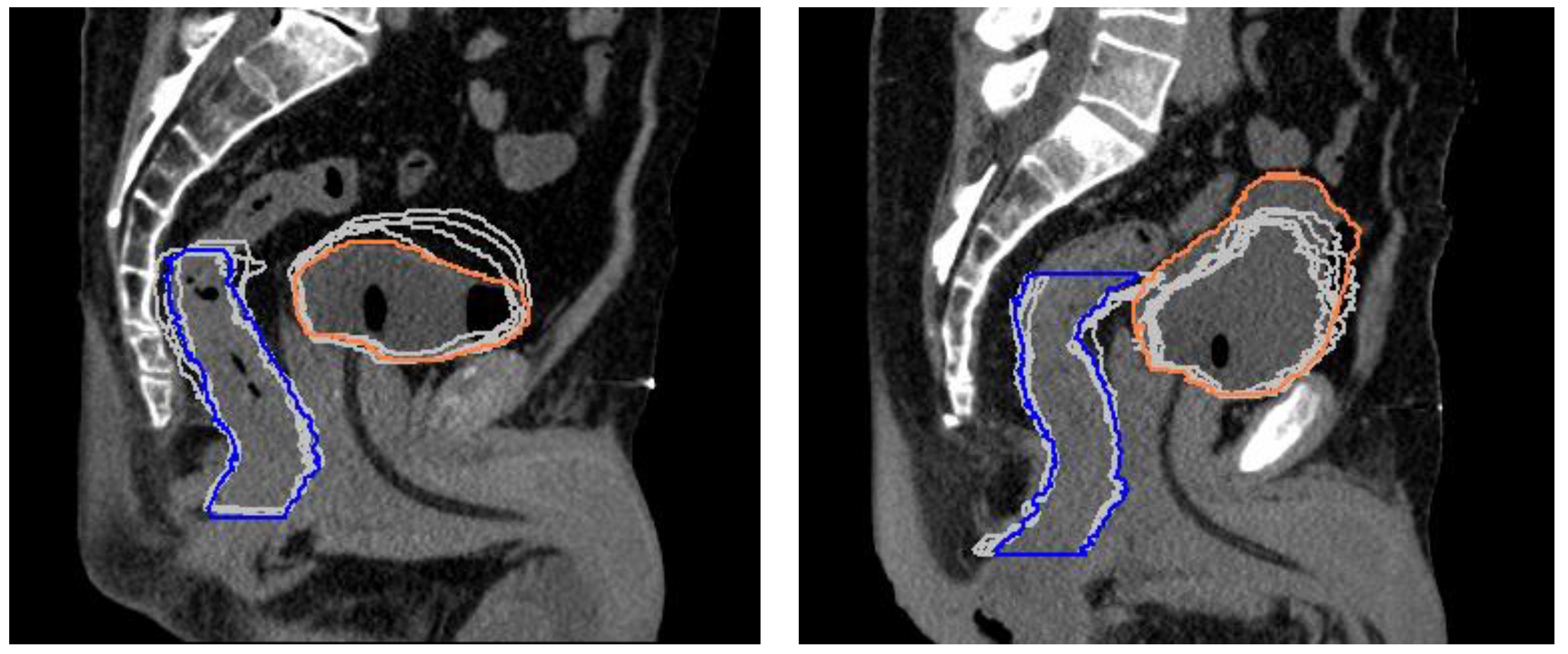 Cancers 15 01153 g003