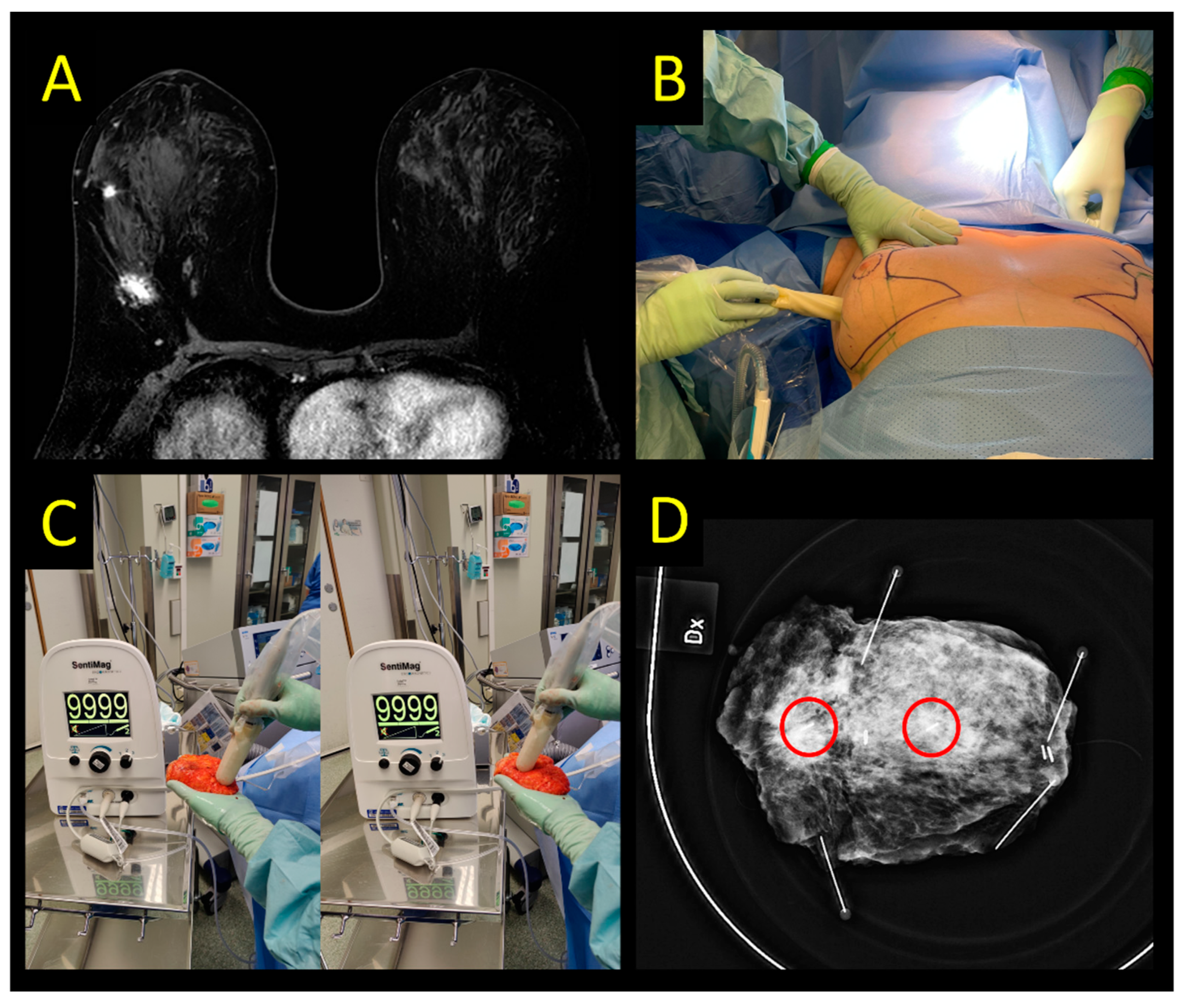 Cancers 15 01173 g003