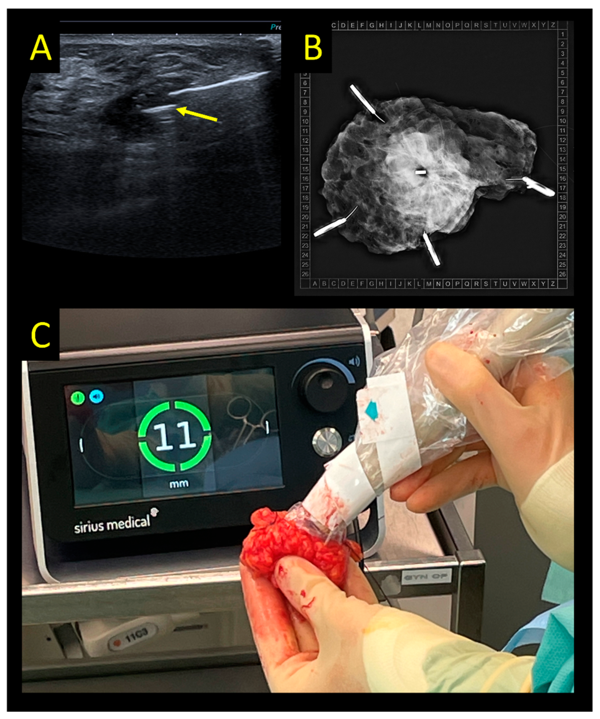 Cancers 15 01173 g004