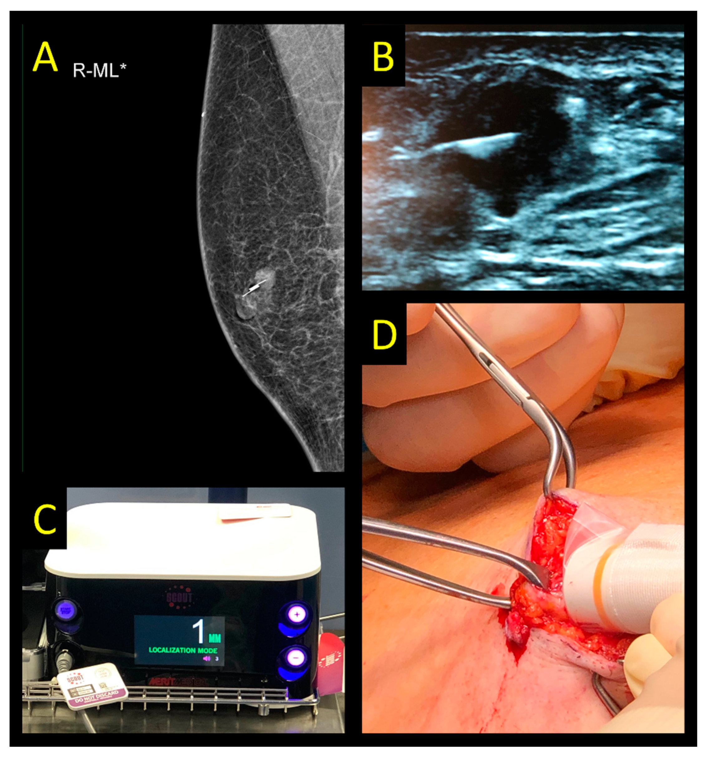 Cancers 15 01173 g005