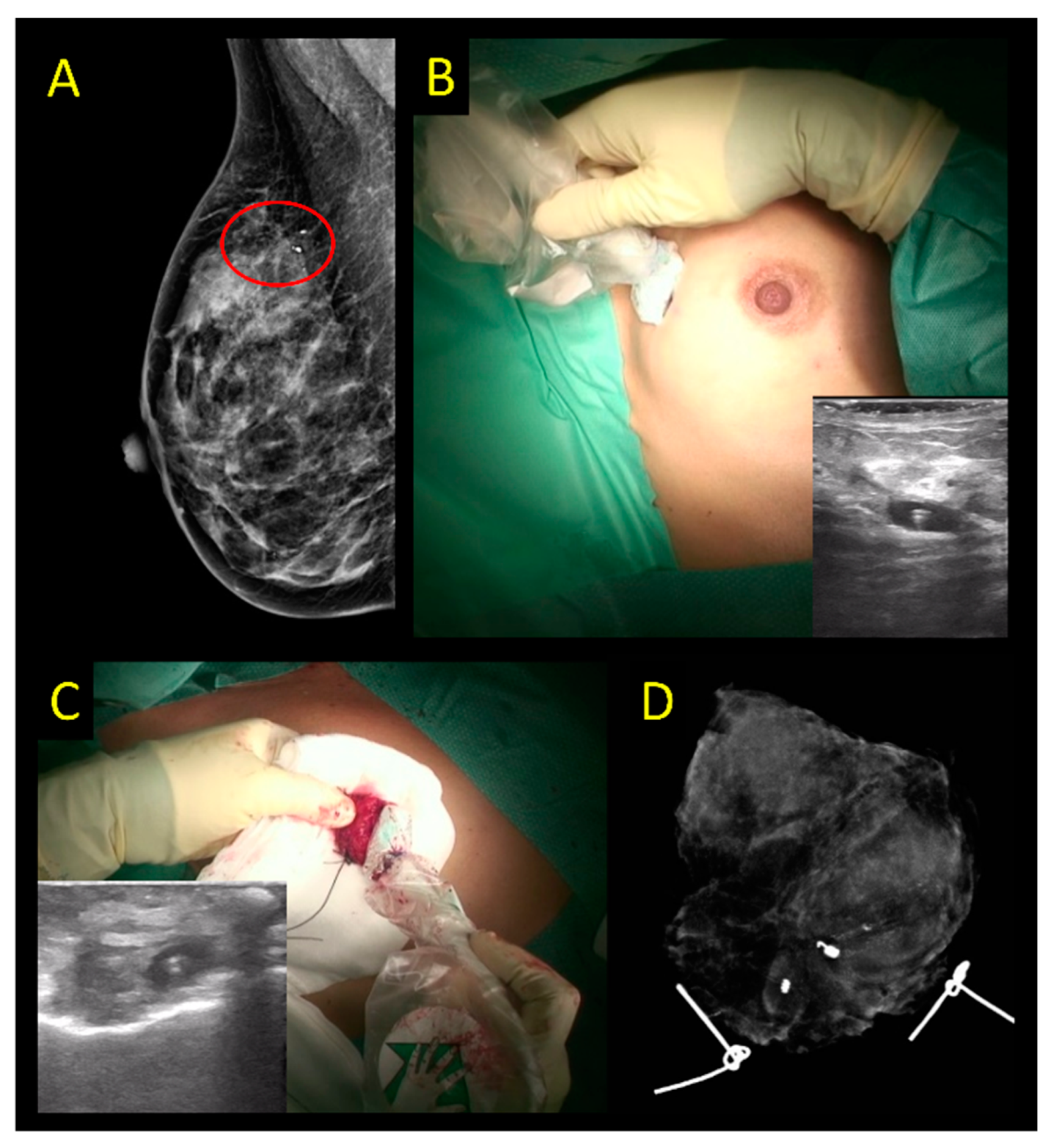 Cancers 15 01173 g007