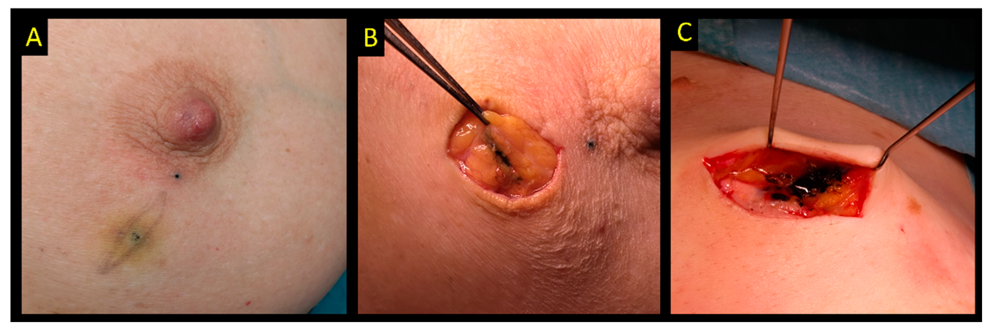 Cancers 15 01173 g008