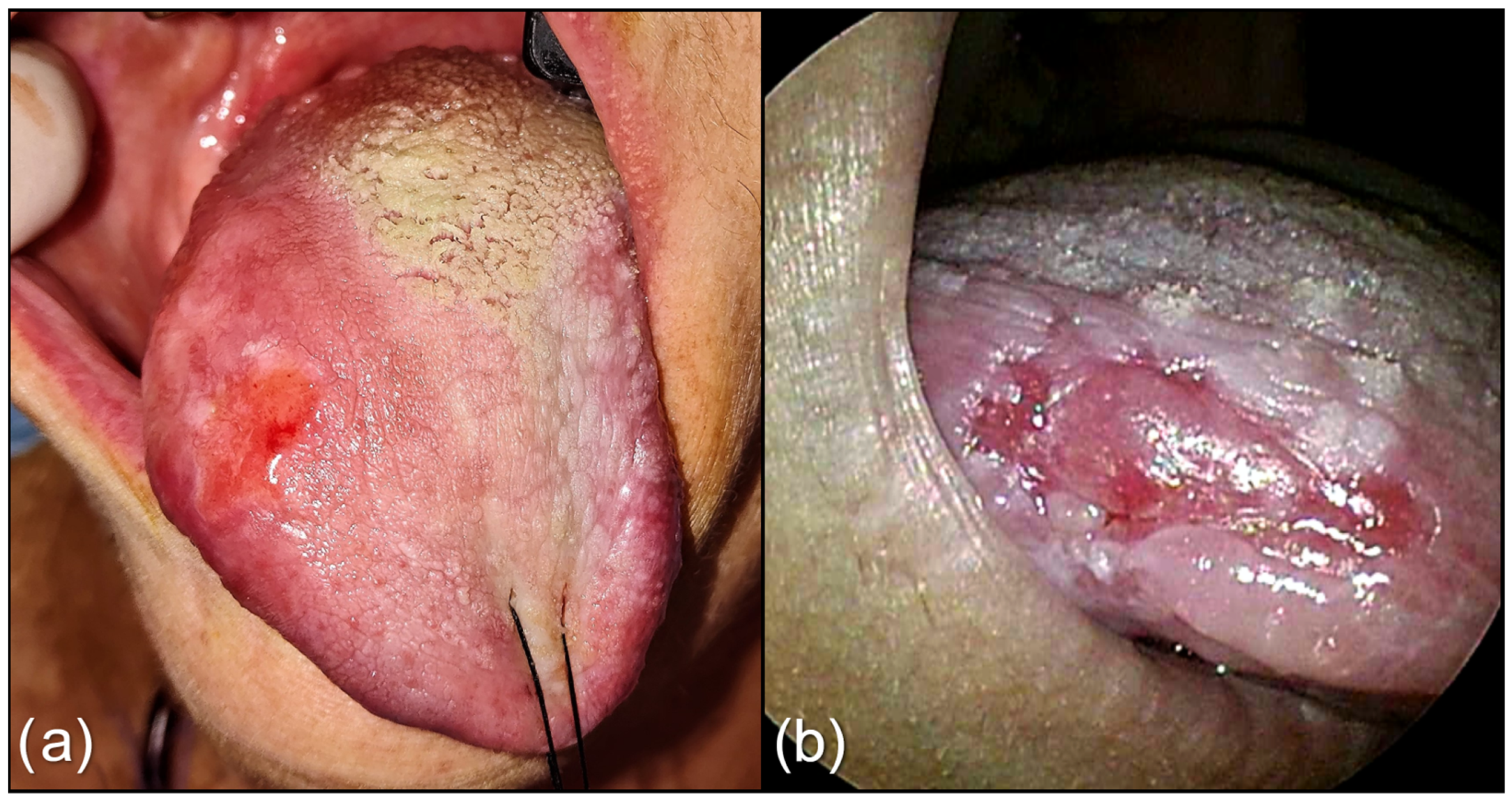 Cancers 15 01196 g001