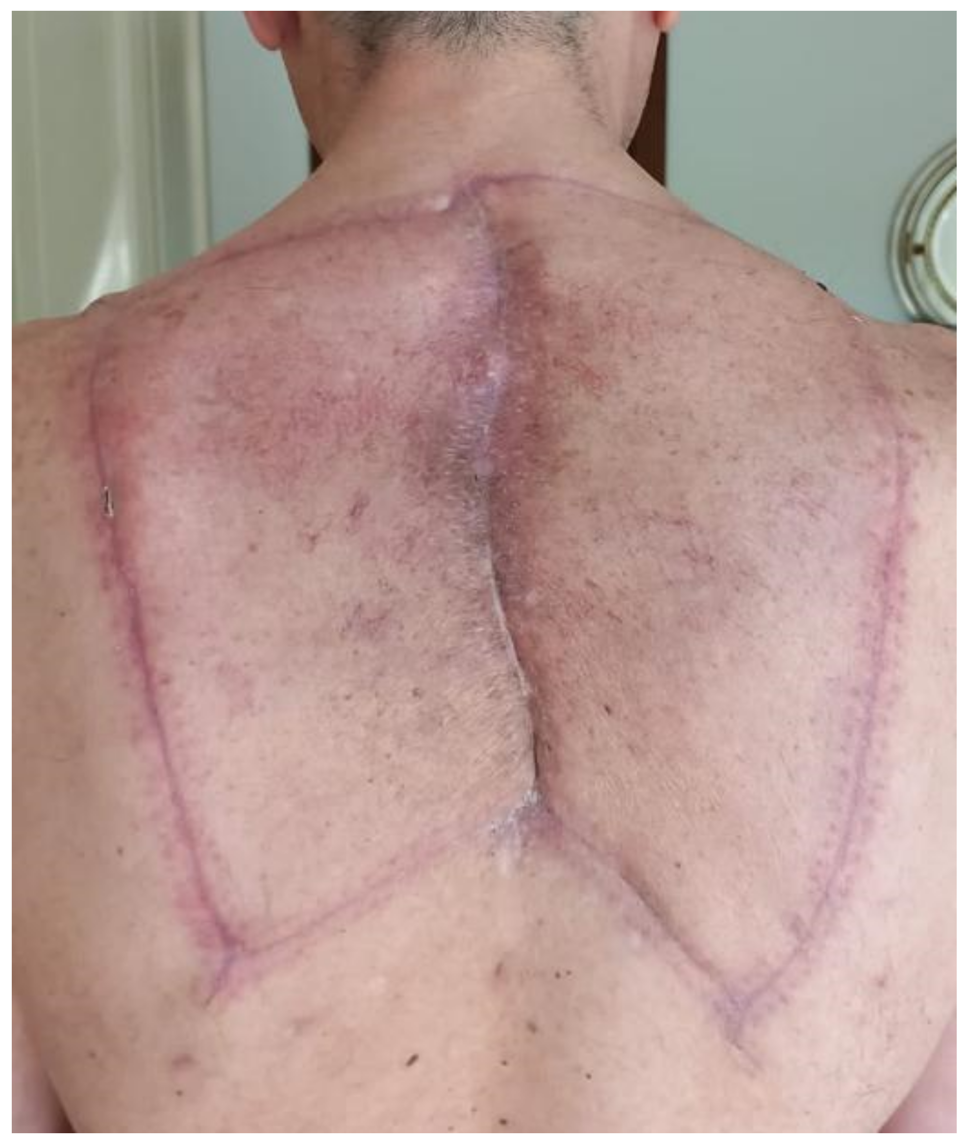 Cancers 15 01214 g001