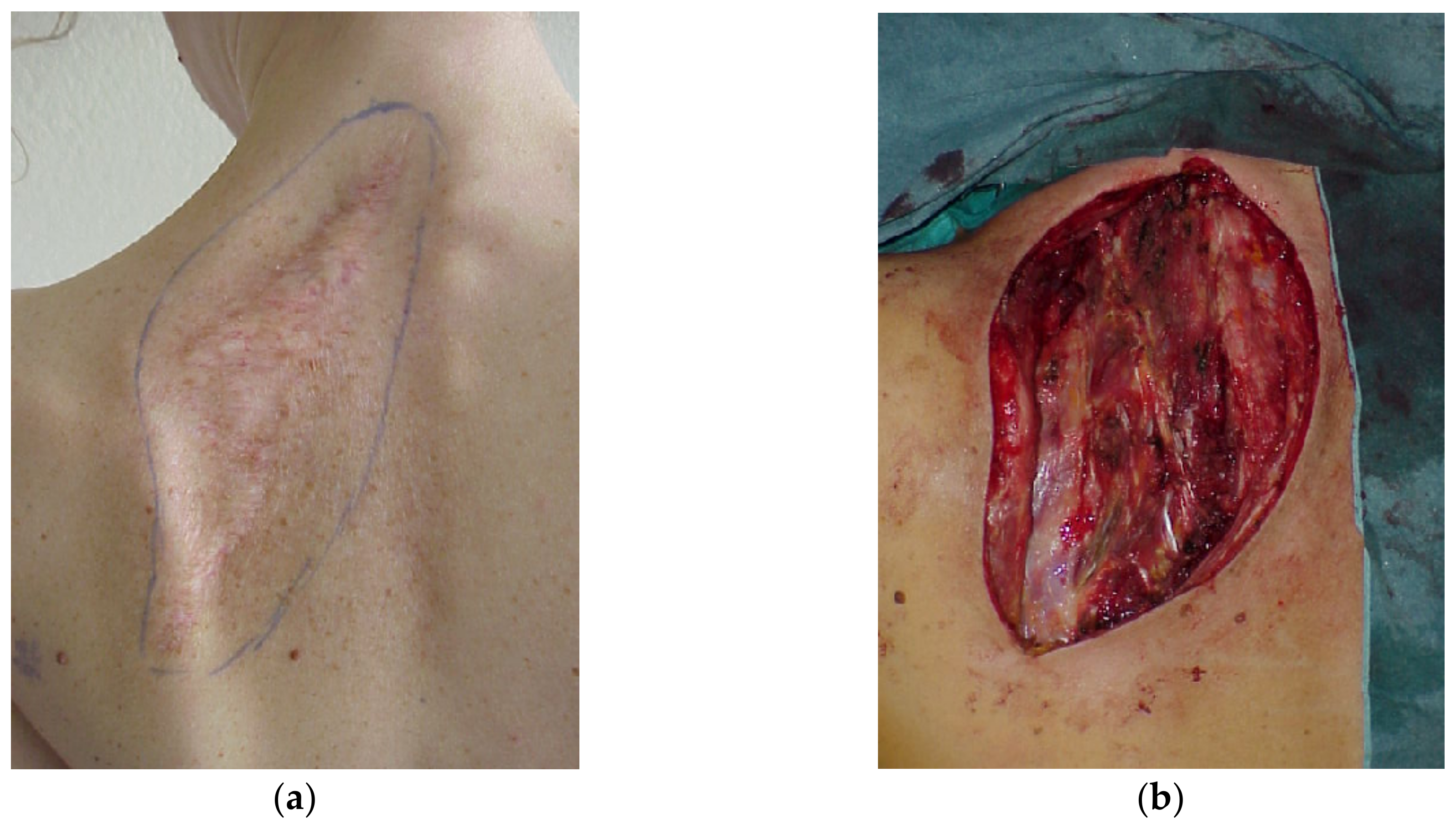 Cancers 15 01214 g002a