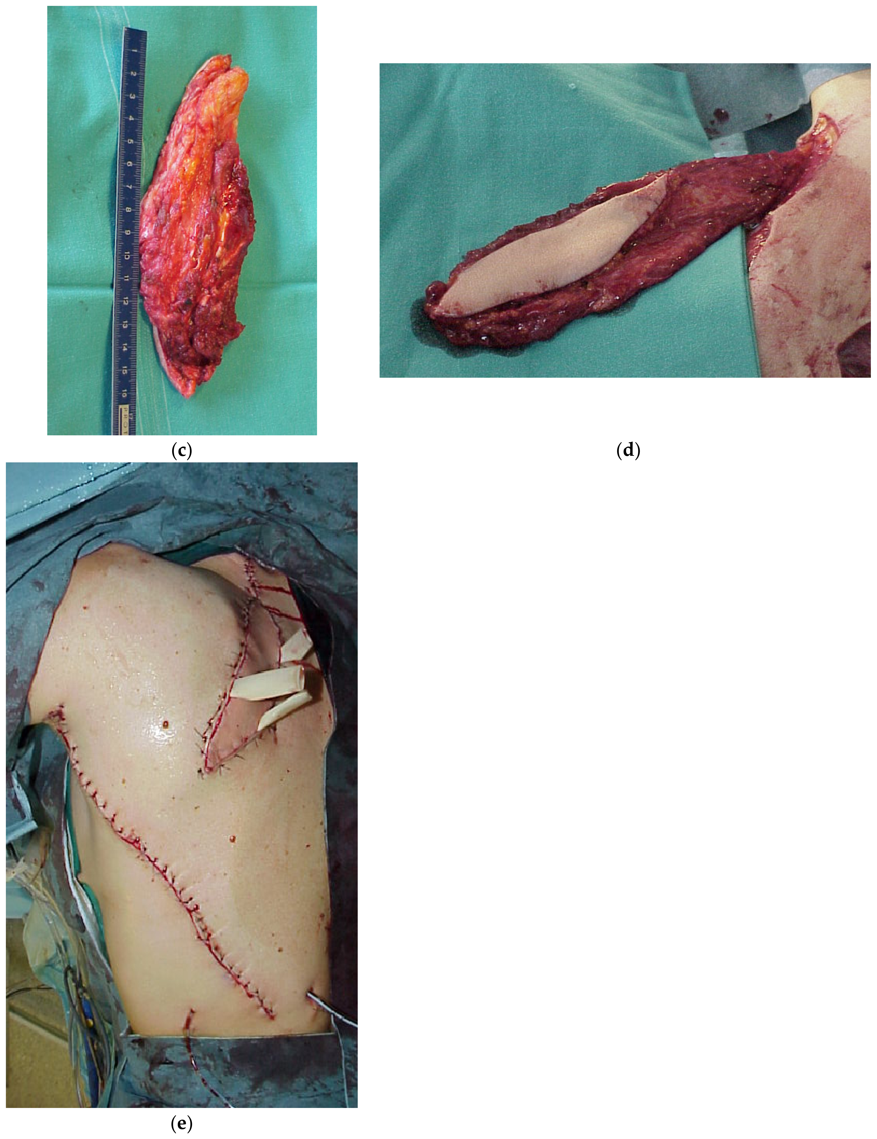 Cancers 15 01214 g002b