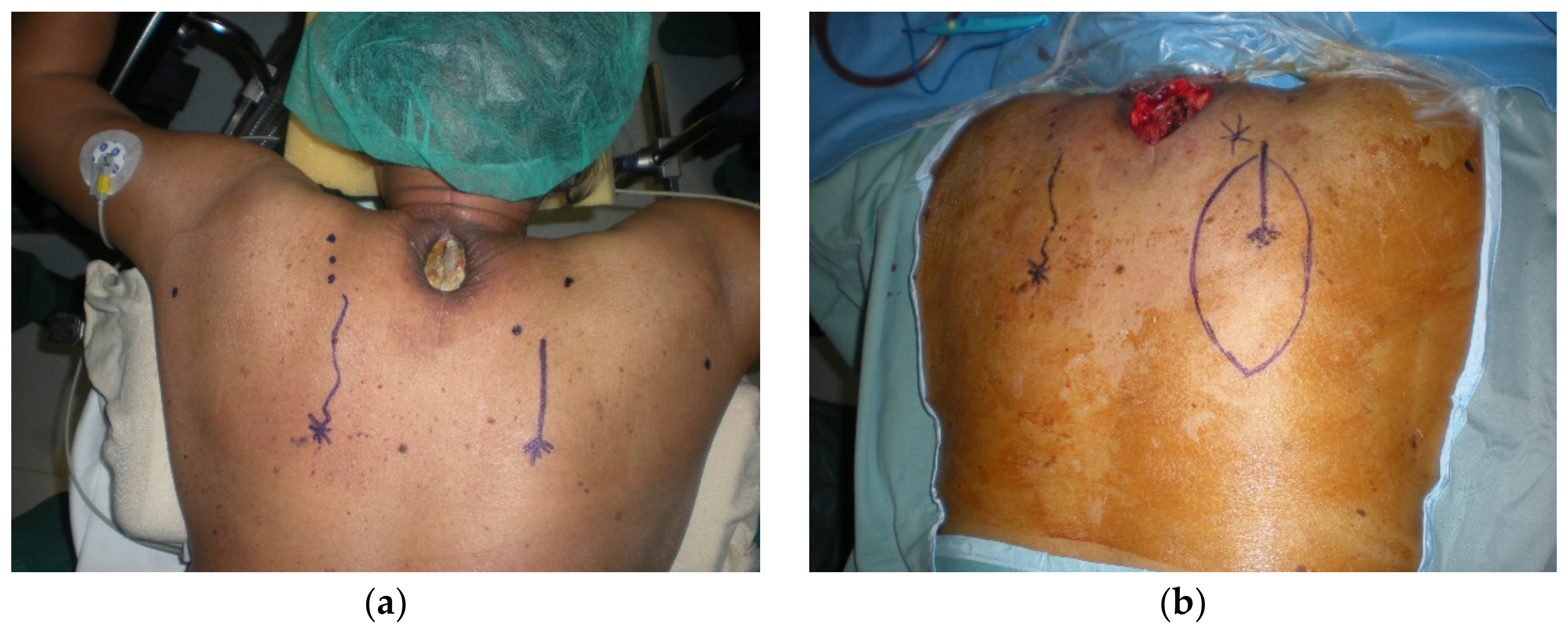 Cancers 15 01214 g005a