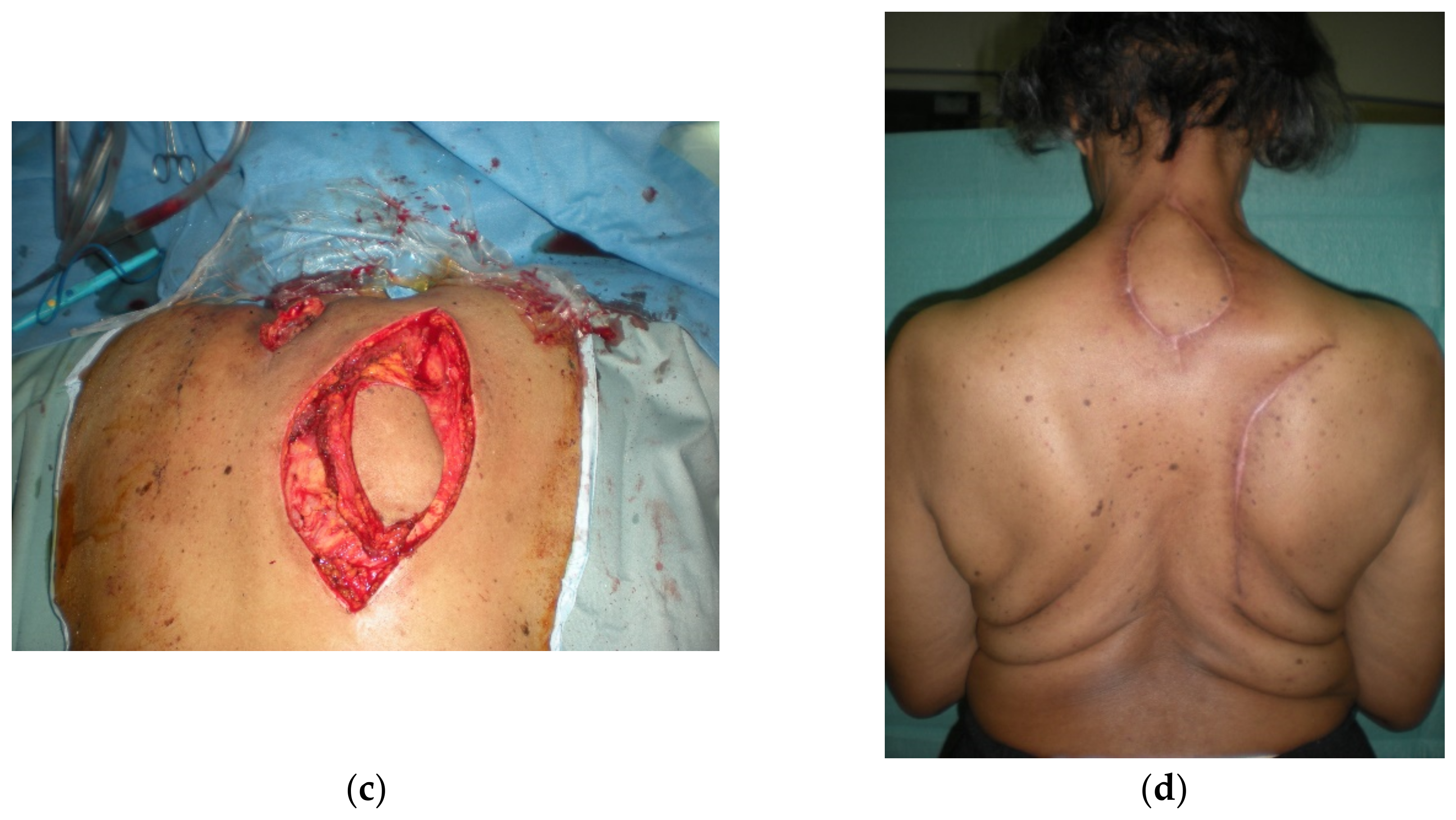 Cancers 15 01214 g005b