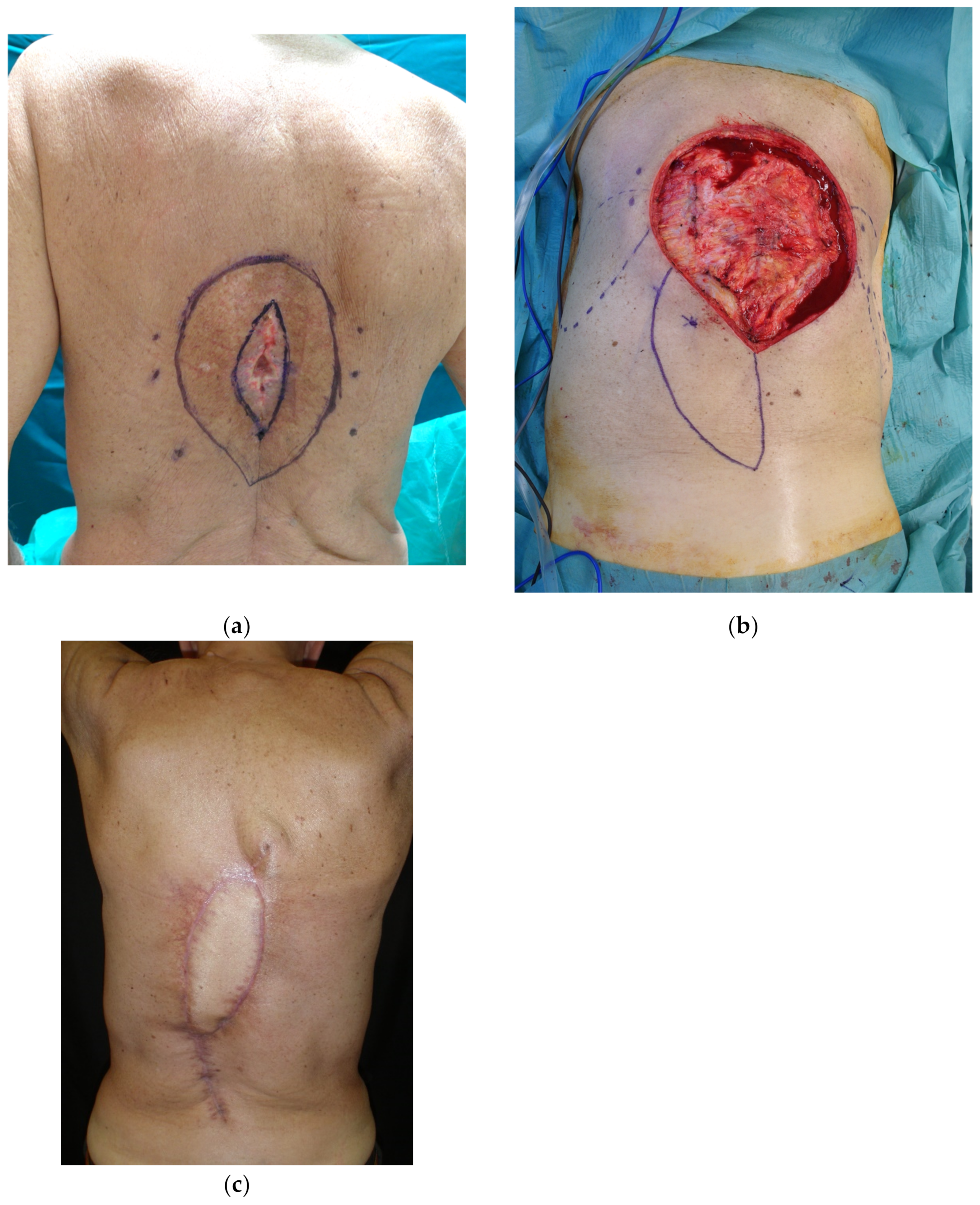 Cancers 15 01214 g007