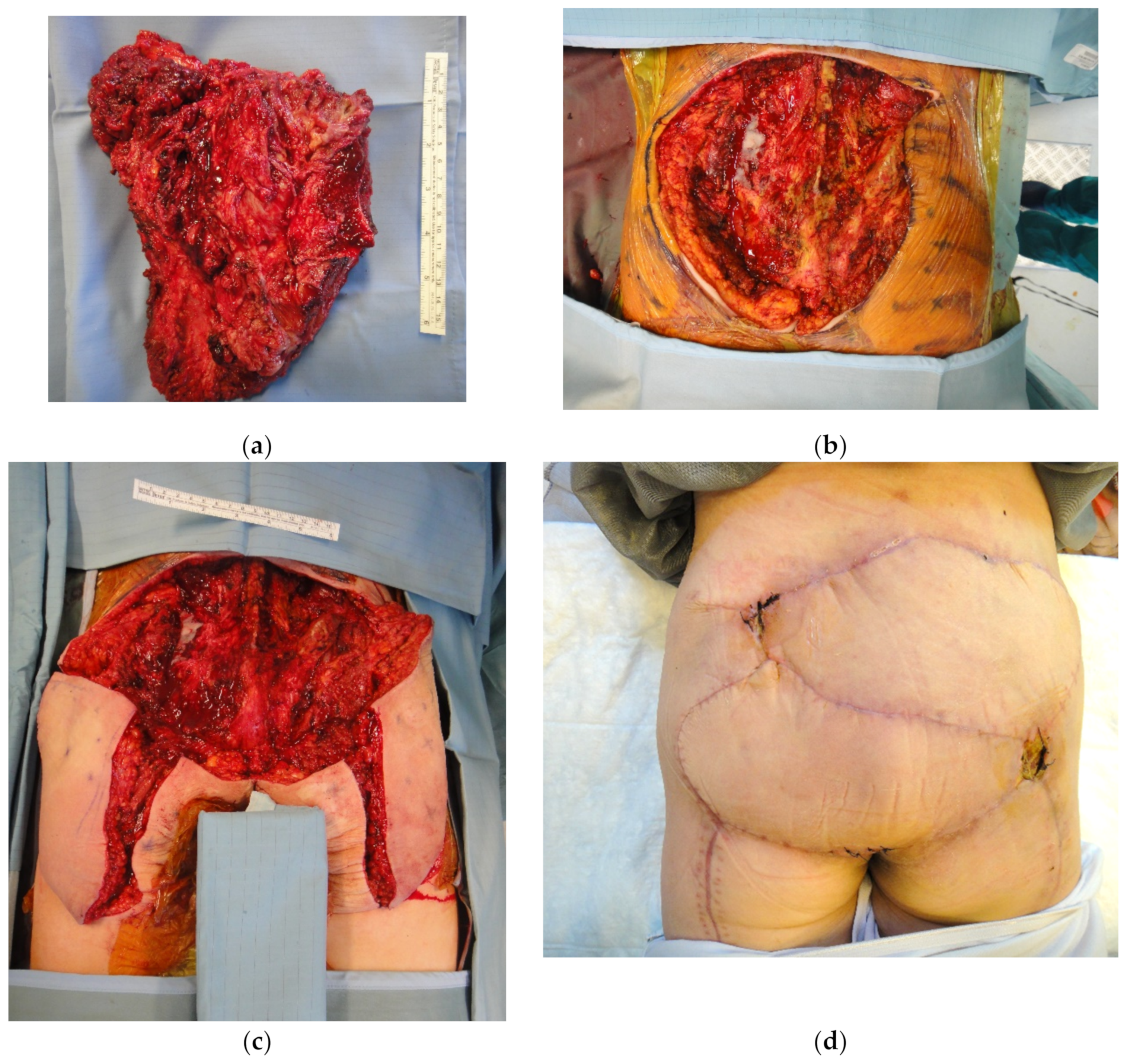 Cancers 15 01214 g008