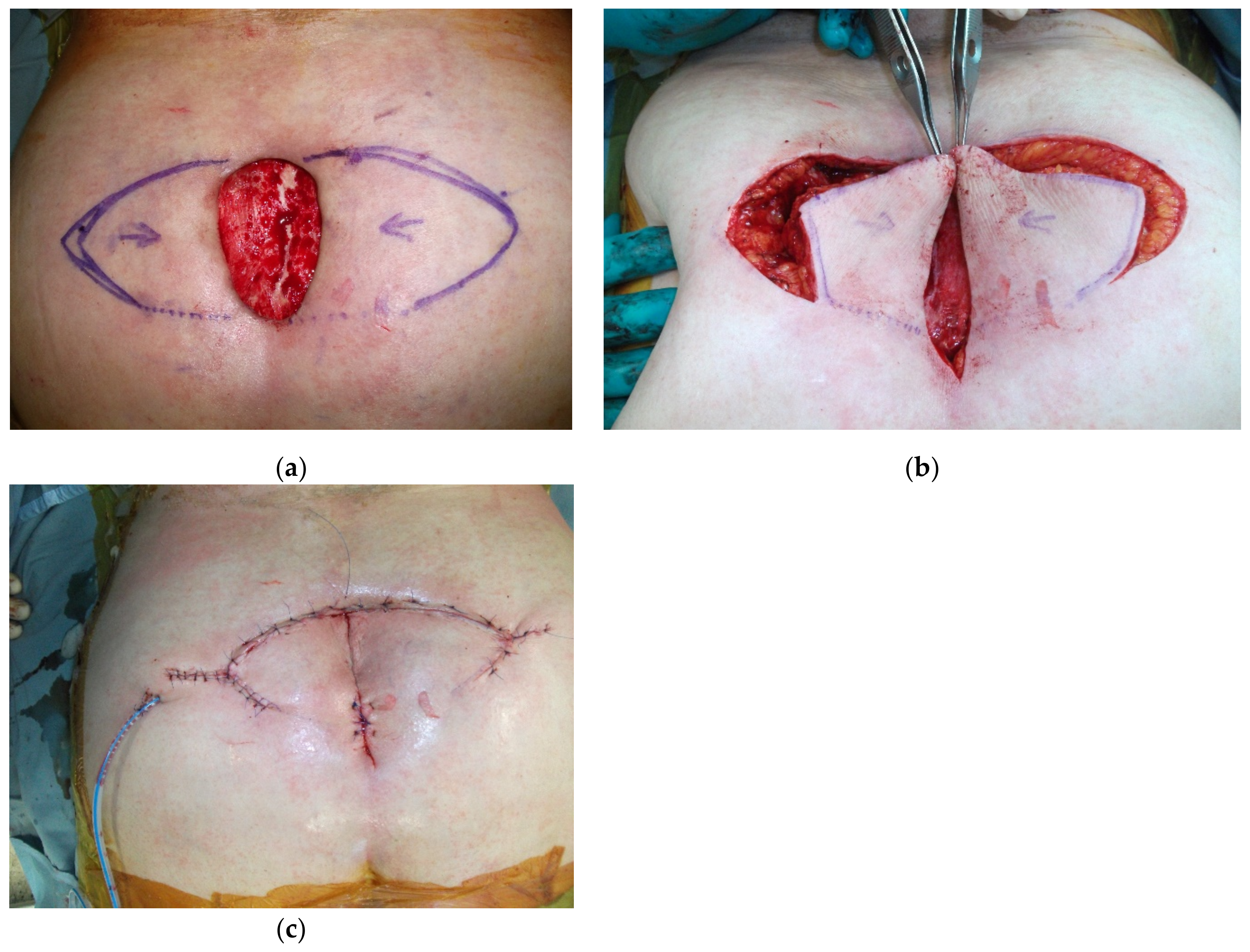 Cancers 15 01214 g009