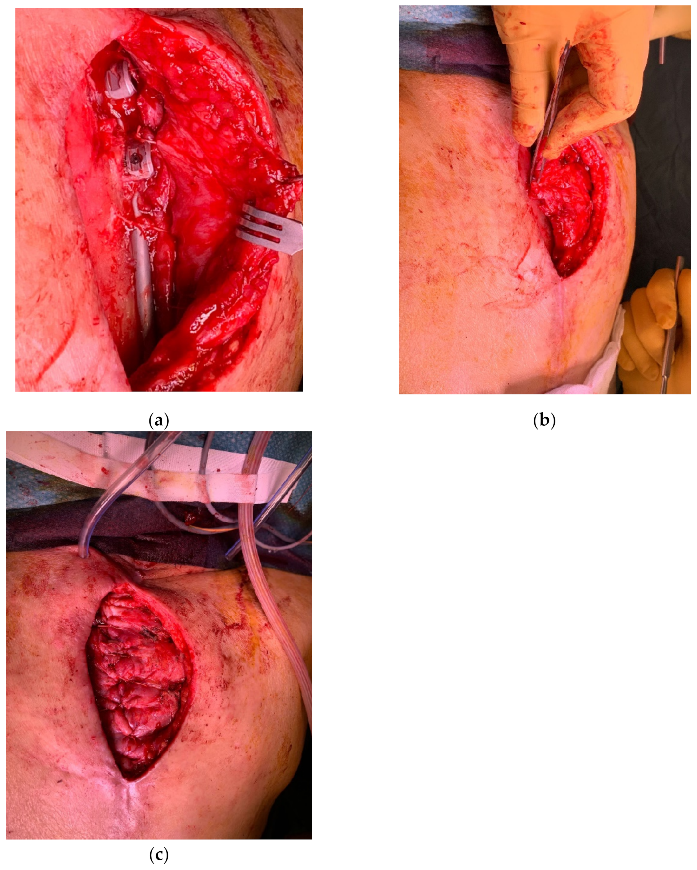 Cancers 15 01214 g010