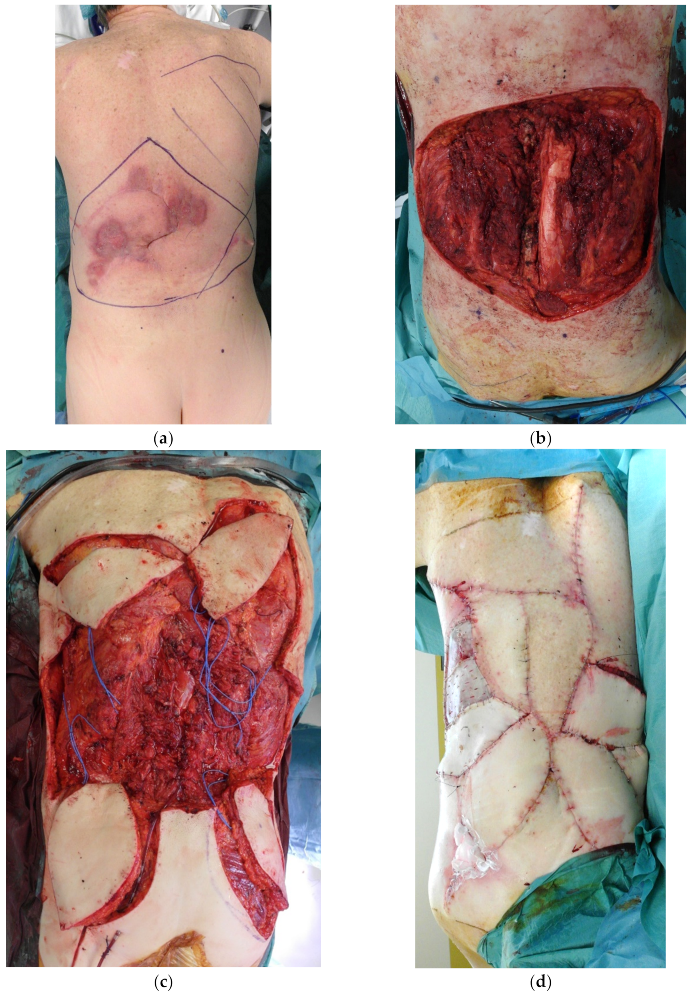 Cancers 15 01214 g011a