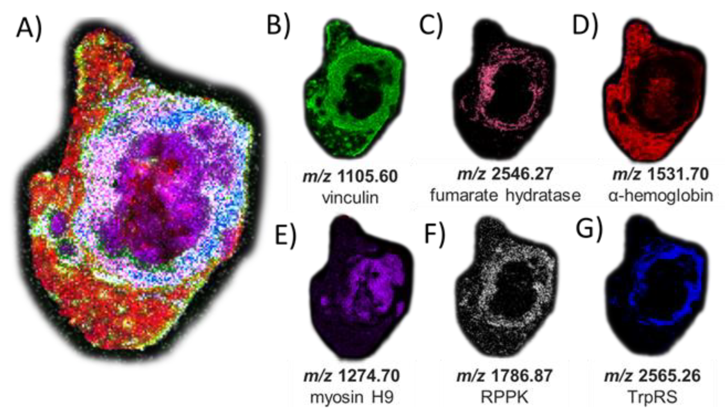Cancers 15 01224 g005