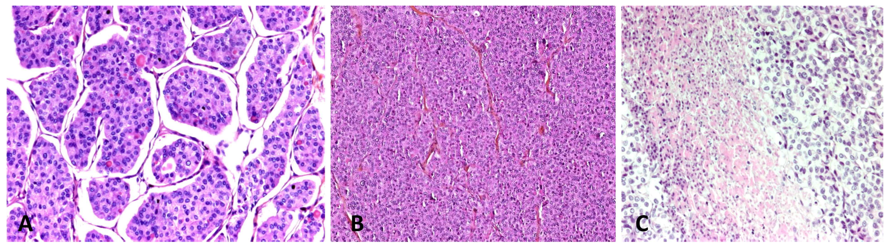 Cancers 15 01255 g001