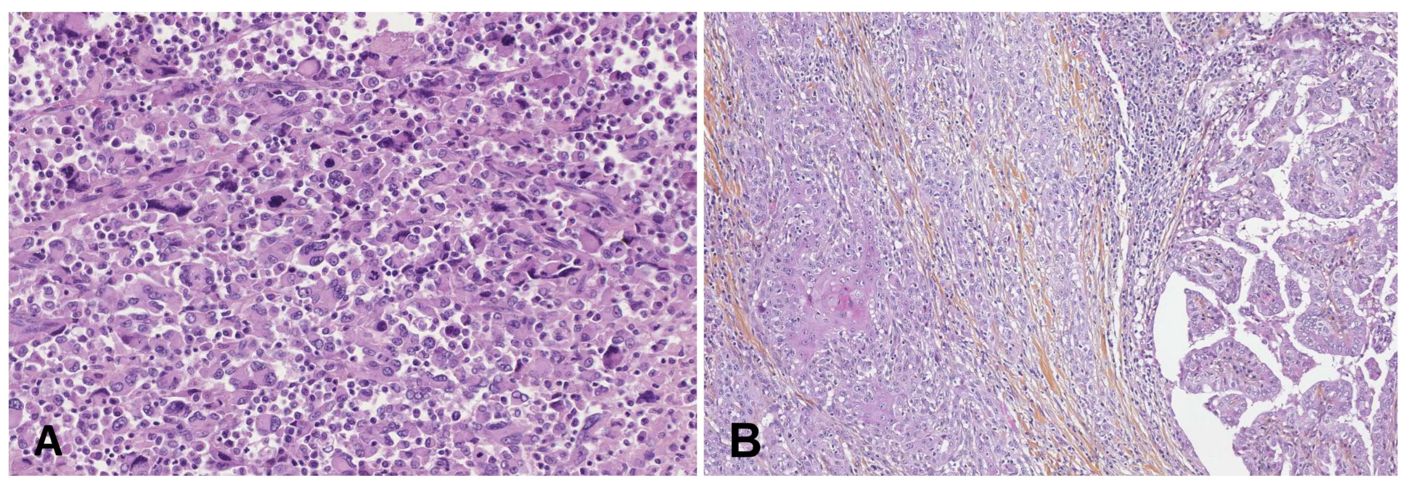 Cancers 15 01255 g002