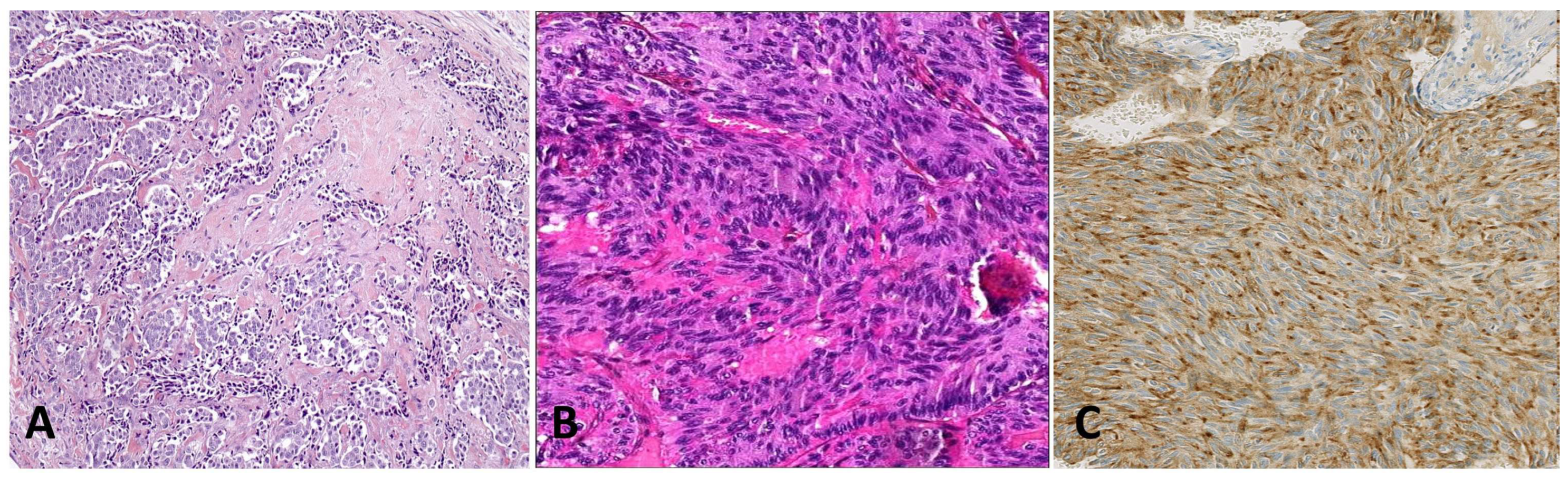 Cancers 15 01255 g003