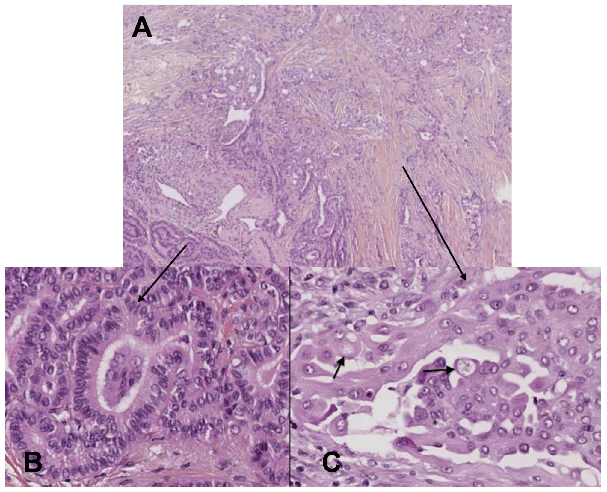 Cancers 15 01255 g004