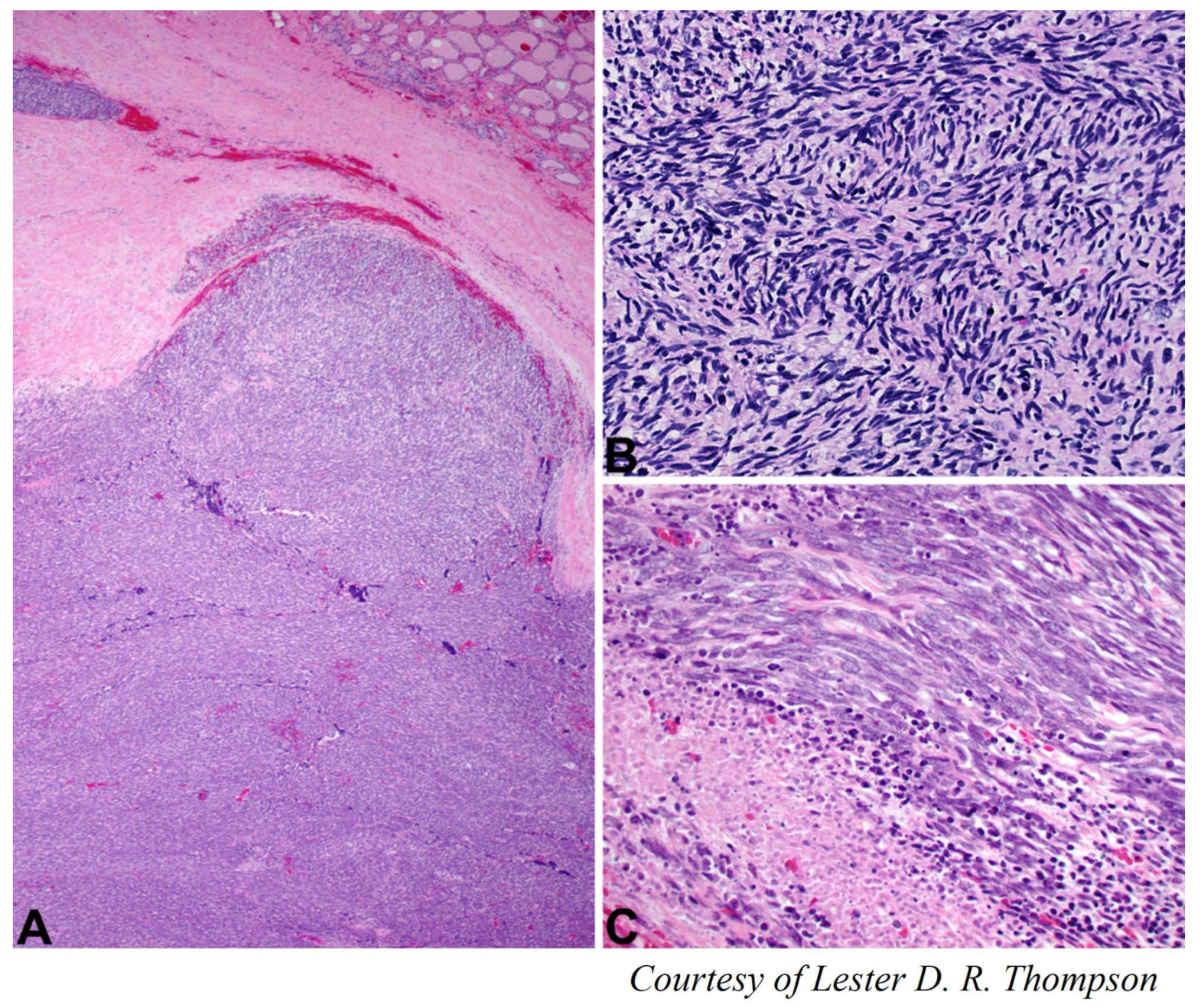 Cancers 15 01255 g005