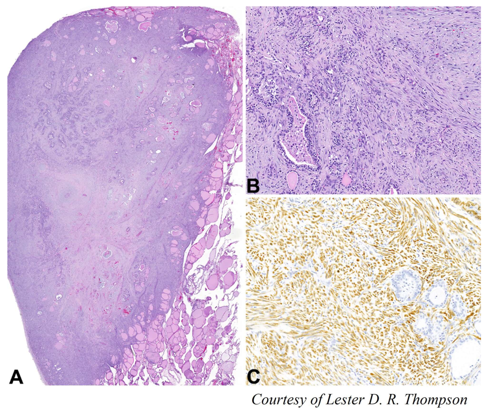 Cancers 15 01255 g007