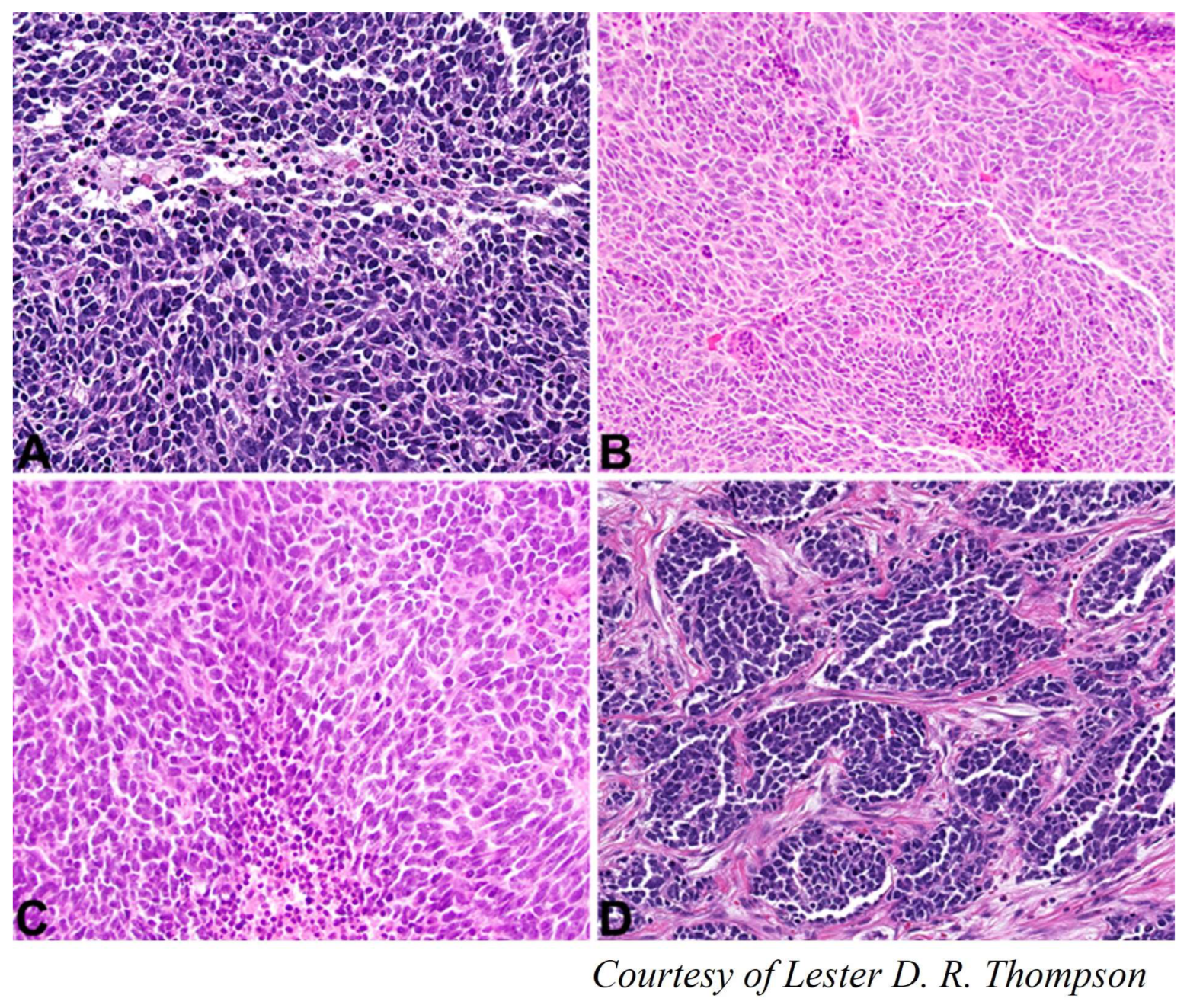 Cancers 15 01255 g008