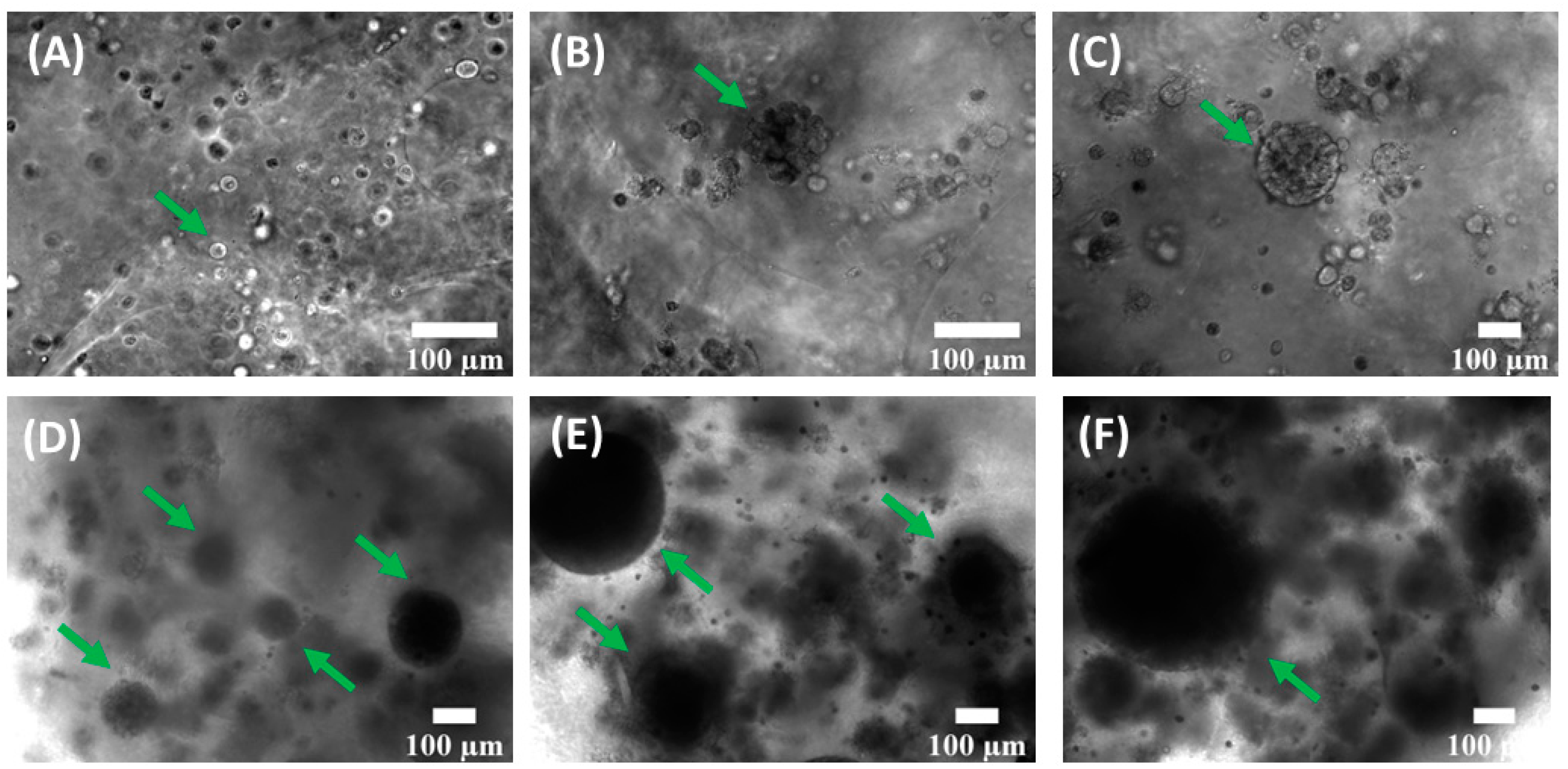 Cancers 15 01327 g003