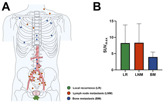Cancers 15 01376 g002