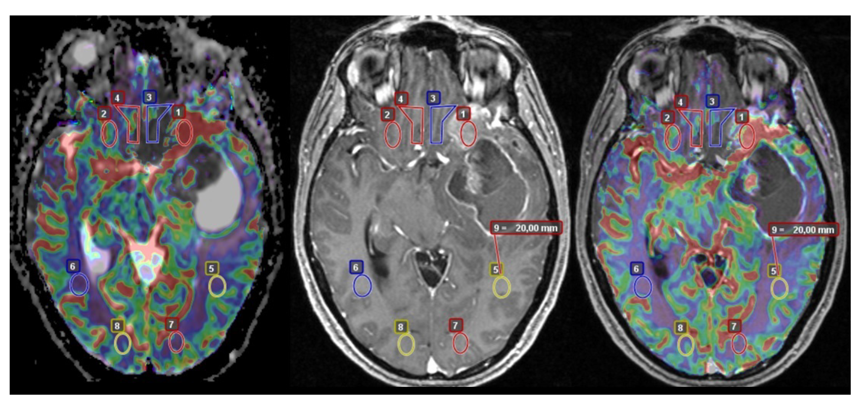 Cancers 15 01384 g001