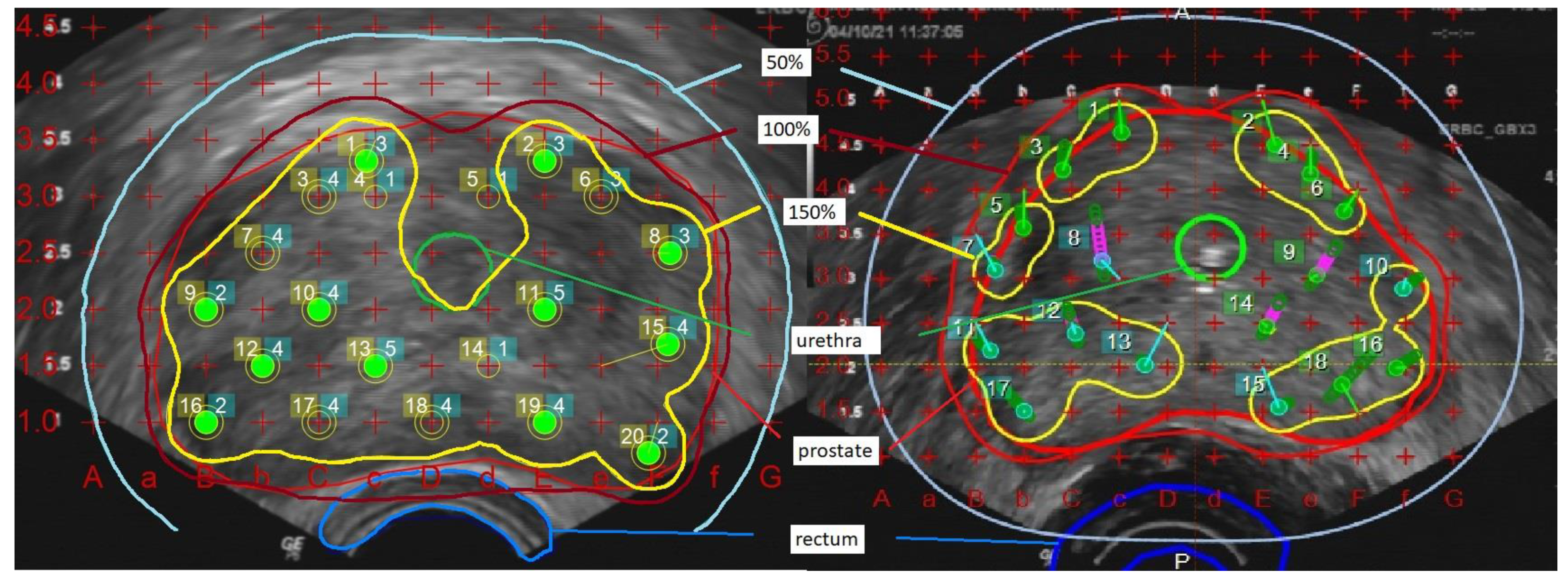 Cancers 15 01396 g001