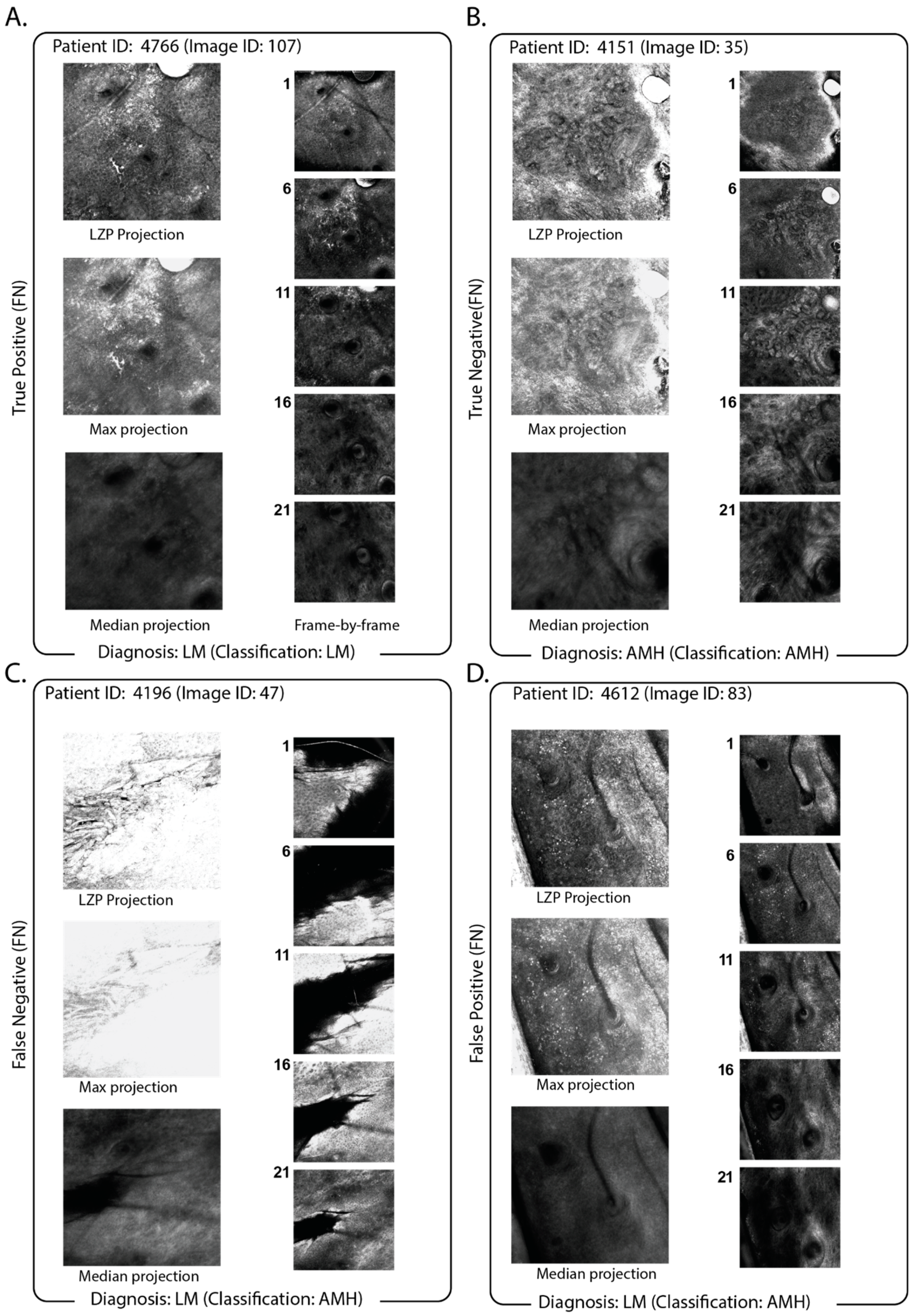 Cancers 15 01428 g004