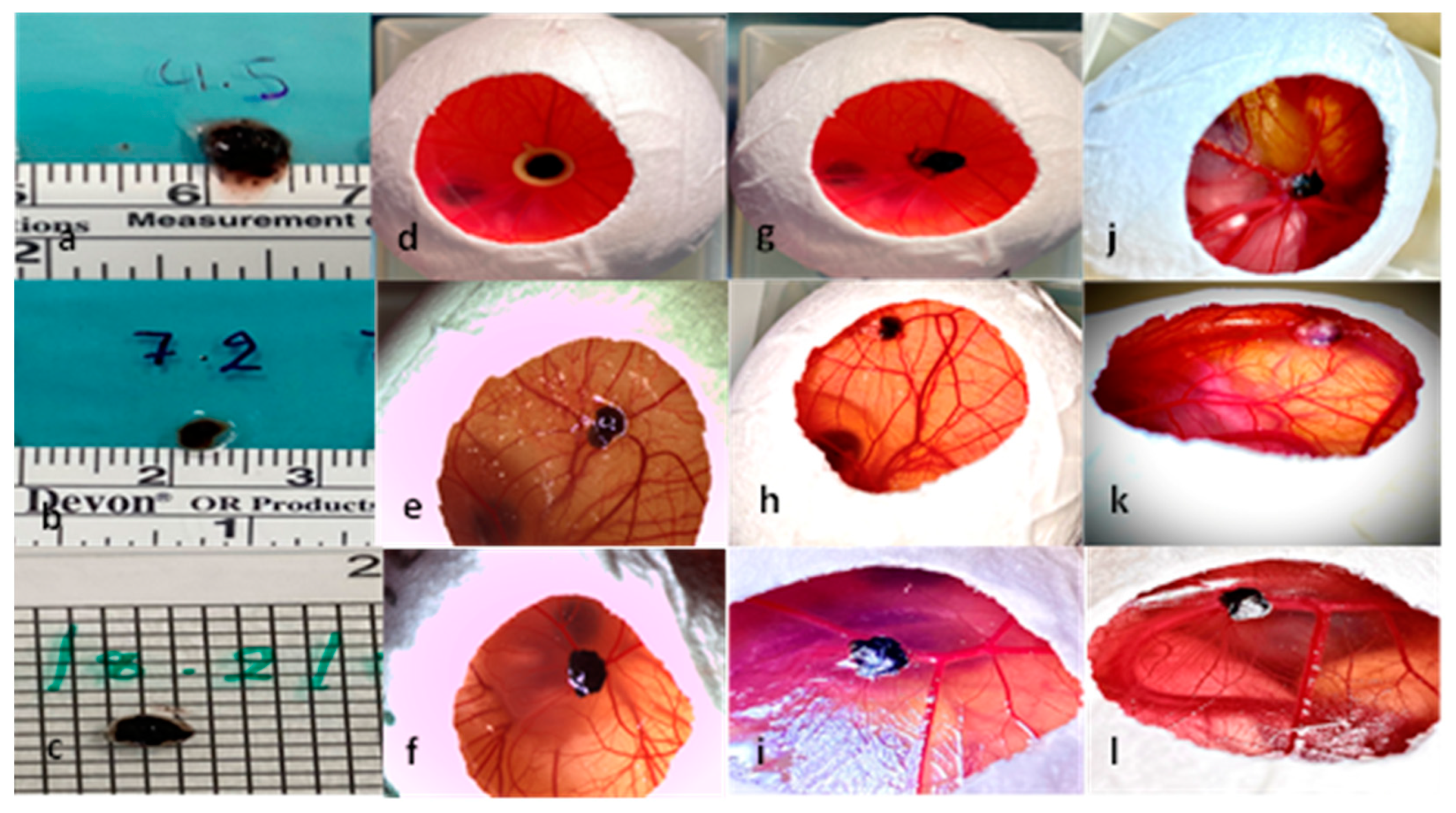 Cancers 15 01436 g002 Cancers 15 01436 g002