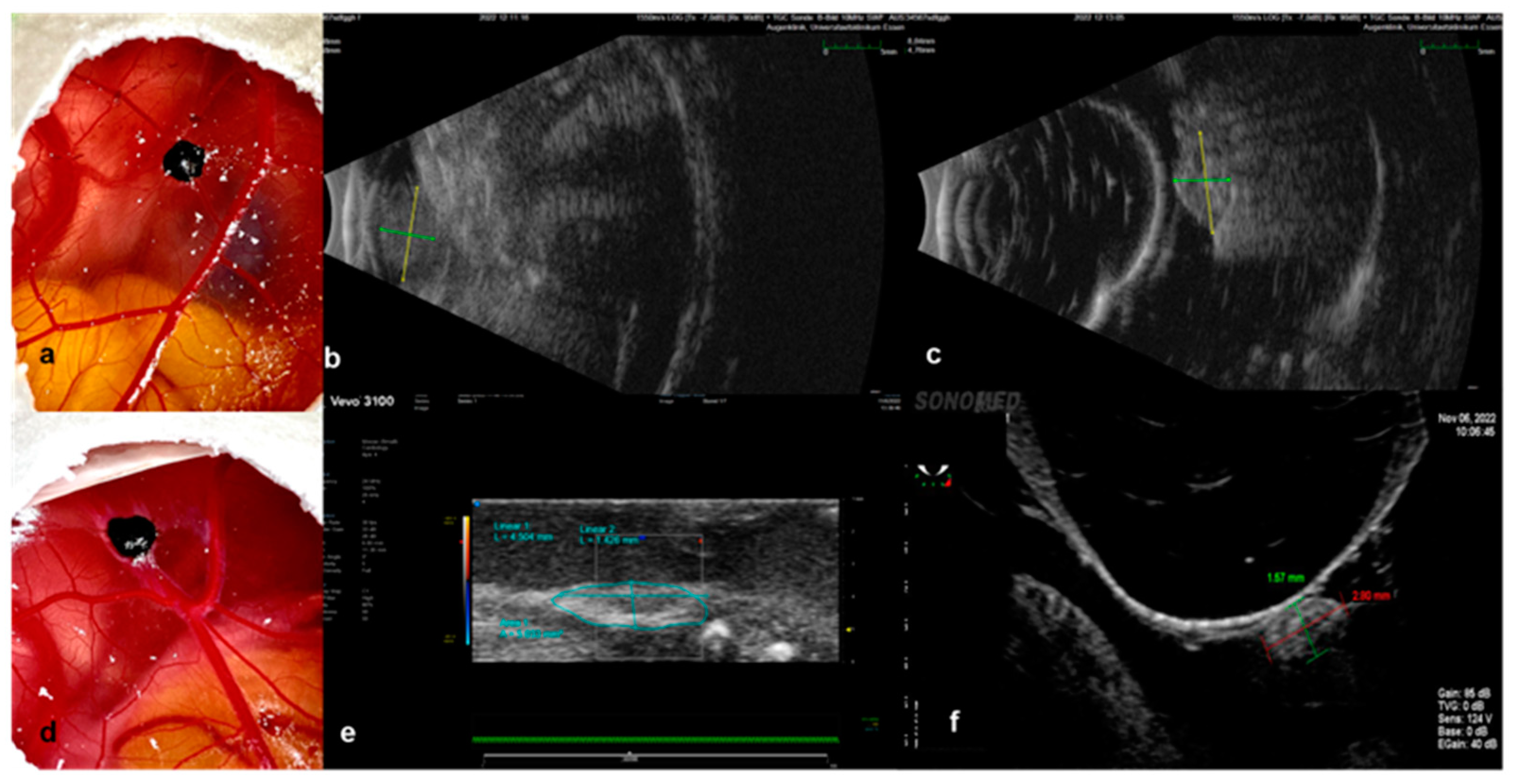 Cancers 15 01436 g007 Cancers 15 01436 g007