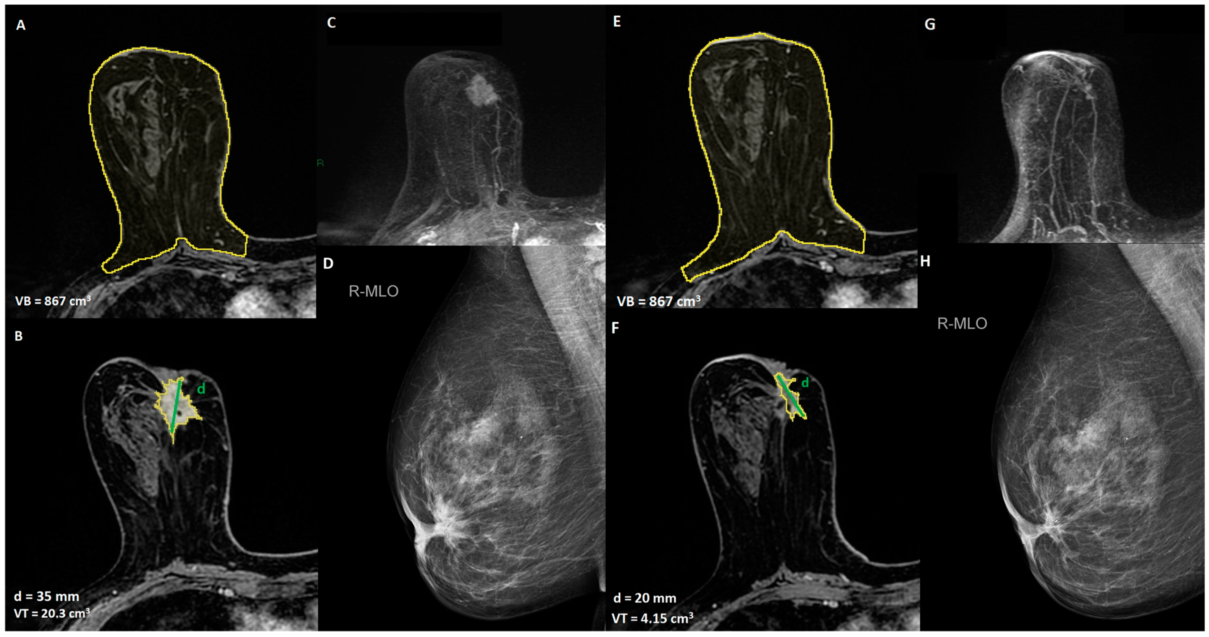 Cancers 15 01439 g001